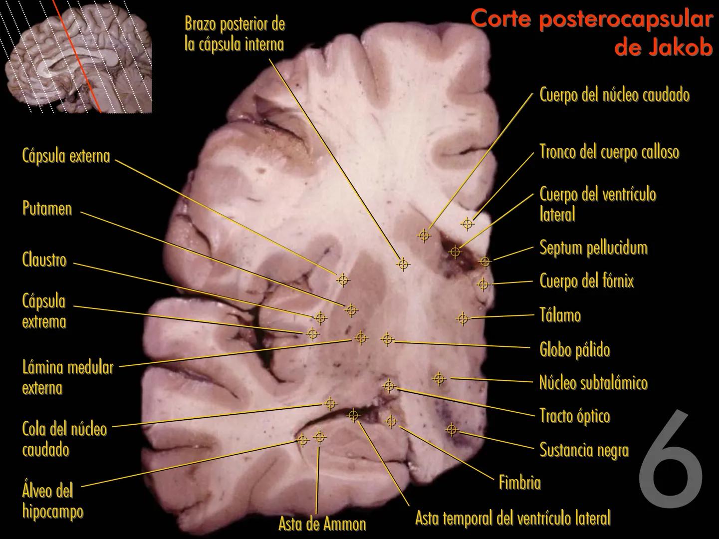 Cortes
de Cerebro
Autores:
Valeria A Forlizzi
Eduardo A Pró
Diseño:
Fernando M Forlizzi
ν.2005.α # Corte sagital medio de encéfalo # Partes