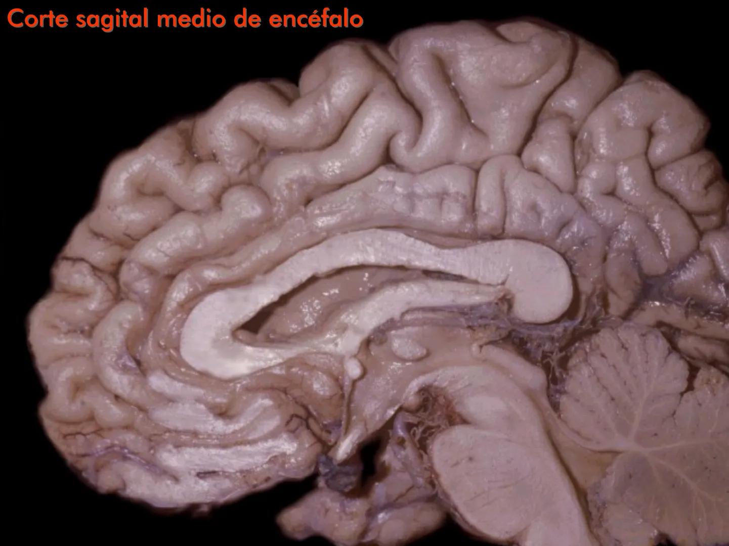 Cortes
de Cerebro
Autores:
Valeria A Forlizzi
Eduardo A Pró
Diseño:
Fernando M Forlizzi
ν.2005.α # Corte sagital medio de encéfalo # Partes
