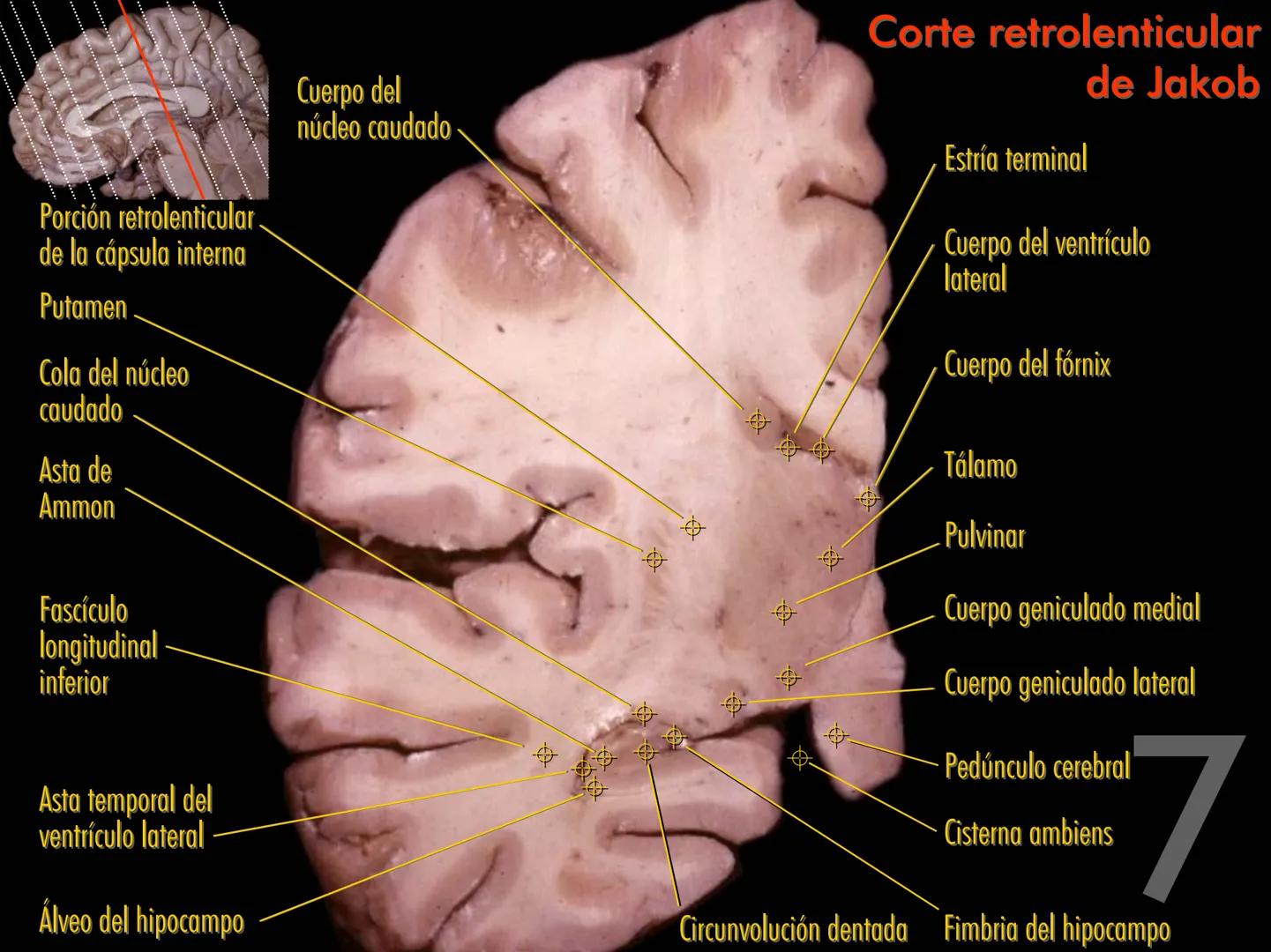 Cortes
de Cerebro
Autores:
Valeria A Forlizzi
Eduardo A Pró
Diseño:
Fernando M Forlizzi
ν.2005.α # Corte sagital medio de encéfalo # Partes