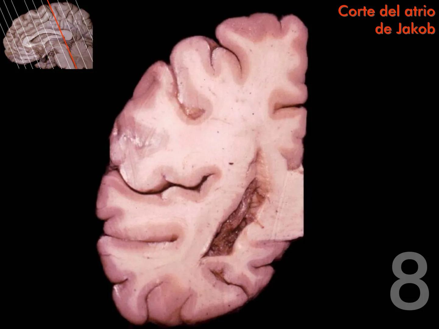 Cortes
de Cerebro
Autores:
Valeria A Forlizzi
Eduardo A Pró
Diseño:
Fernando M Forlizzi
ν.2005.α # Corte sagital medio de encéfalo # Partes