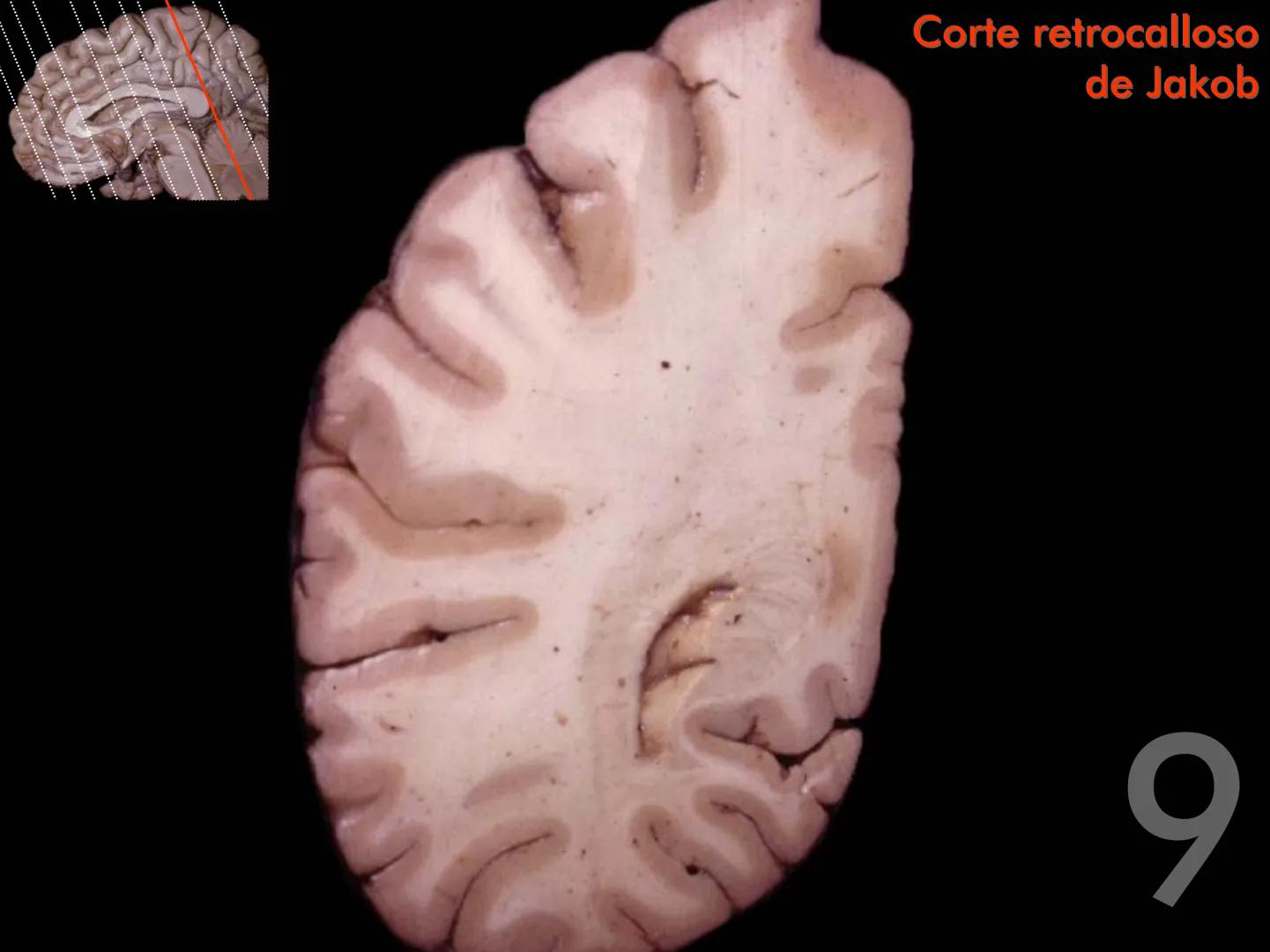 Cortes
de Cerebro
Autores:
Valeria A Forlizzi
Eduardo A Pró
Diseño:
Fernando M Forlizzi
ν.2005.α # Corte sagital medio de encéfalo # Partes
