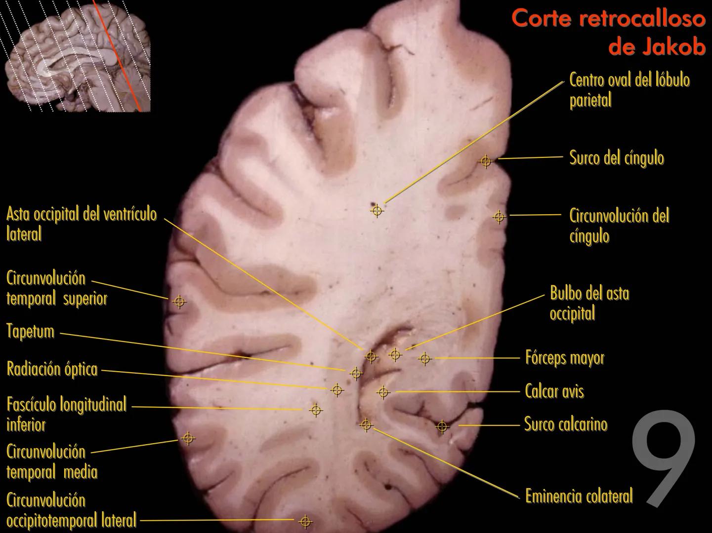 Cortes
de Cerebro
Autores:
Valeria A Forlizzi
Eduardo A Pró
Diseño:
Fernando M Forlizzi
ν.2005.α # Corte sagital medio de encéfalo # Partes
