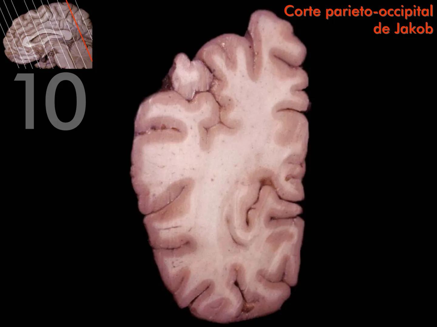 Cortes
de Cerebro
Autores:
Valeria A Forlizzi
Eduardo A Pró
Diseño:
Fernando M Forlizzi
ν.2005.α # Corte sagital medio de encéfalo # Partes