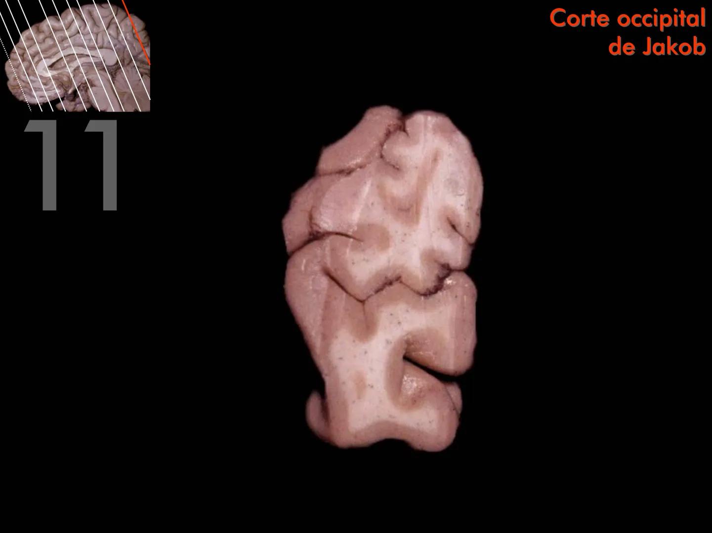 Cortes
de Cerebro
Autores:
Valeria A Forlizzi
Eduardo A Pró
Diseño:
Fernando M Forlizzi
ν.2005.α # Corte sagital medio de encéfalo # Partes