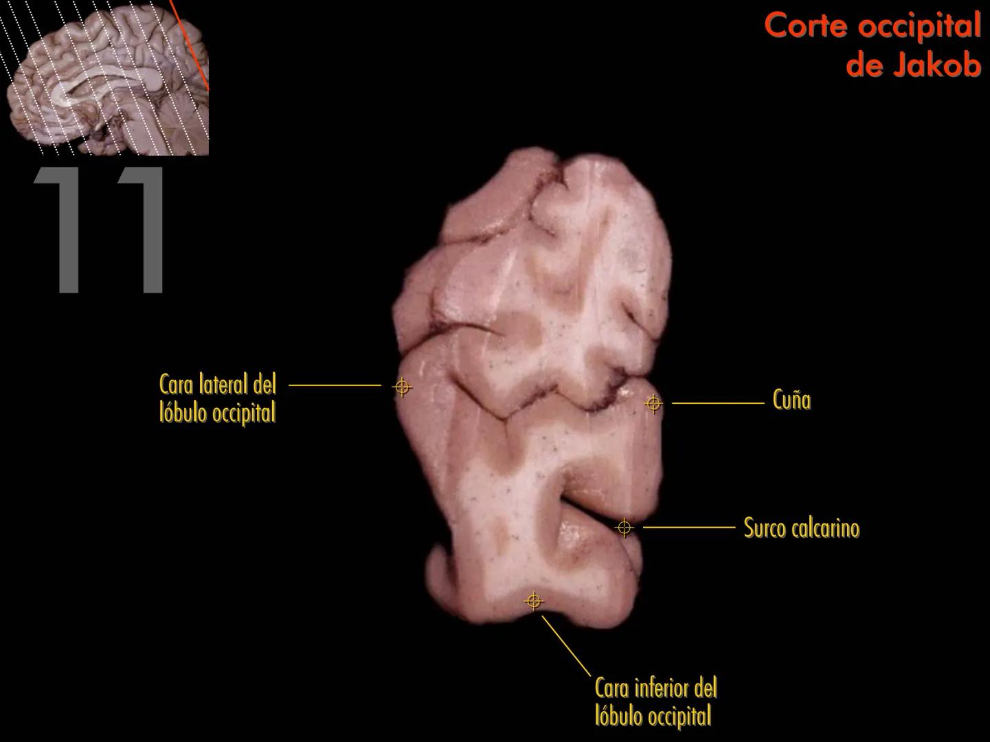 Cortes
de Cerebro
Autores:
Valeria A Forlizzi
Eduardo A Pró
Diseño:
Fernando M Forlizzi
ν.2005.α # Corte sagital medio de encéfalo # Partes