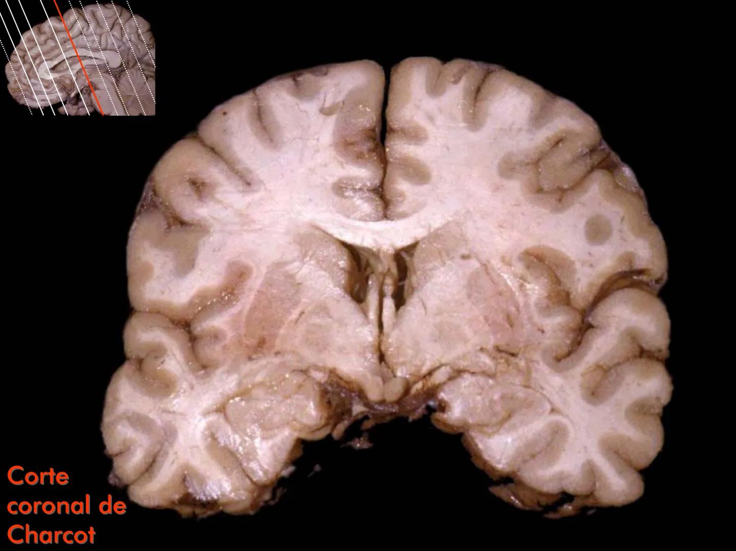Cortes
de Cerebro
Autores:
Valeria A Forlizzi
Eduardo A Pró
Diseño:
Fernando M Forlizzi
ν.2005.α # Corte sagital medio de encéfalo # Partes