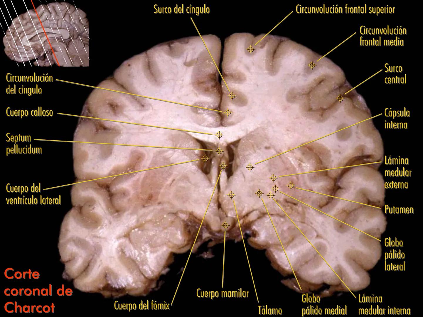 Cortes
de Cerebro
Autores:
Valeria A Forlizzi
Eduardo A Pró
Diseño:
Fernando M Forlizzi
ν.2005.α # Corte sagital medio de encéfalo # Partes