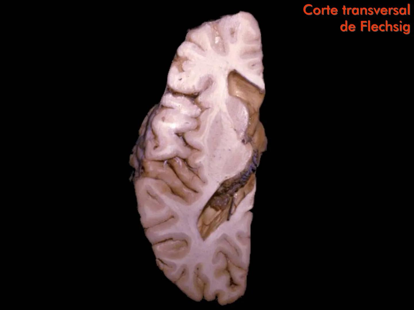 Cortes
de Cerebro
Autores:
Valeria A Forlizzi
Eduardo A Pró
Diseño:
Fernando M Forlizzi
ν.2005.α # Corte sagital medio de encéfalo # Partes