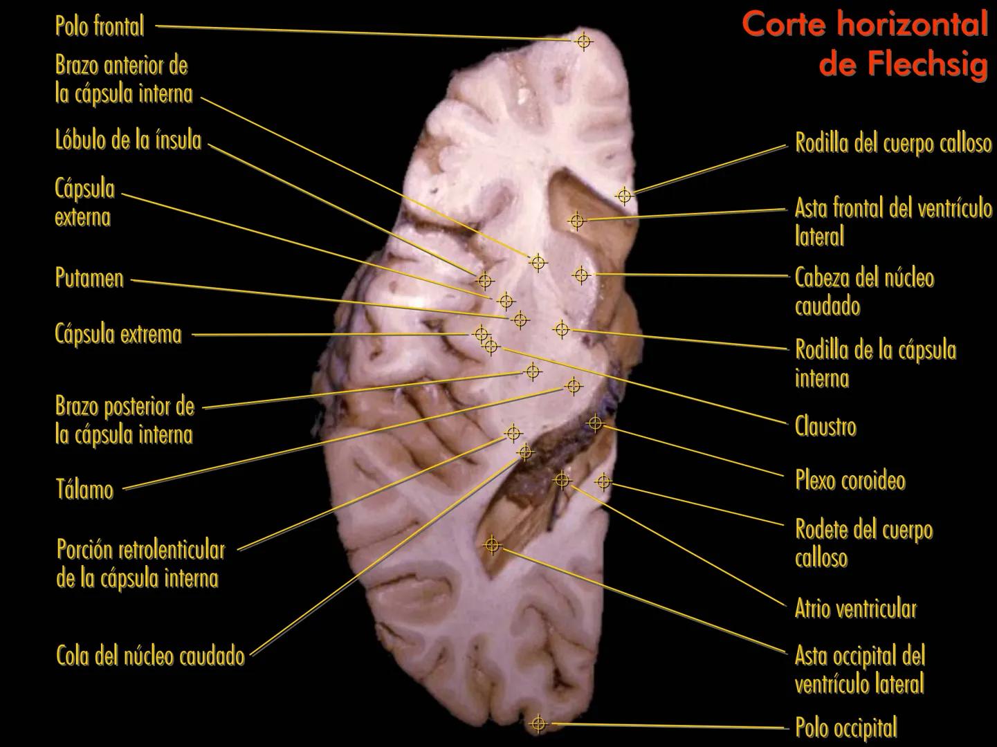 Cortes
de Cerebro
Autores:
Valeria A Forlizzi
Eduardo A Pró
Diseño:
Fernando M Forlizzi
ν.2005.α # Corte sagital medio de encéfalo # Partes