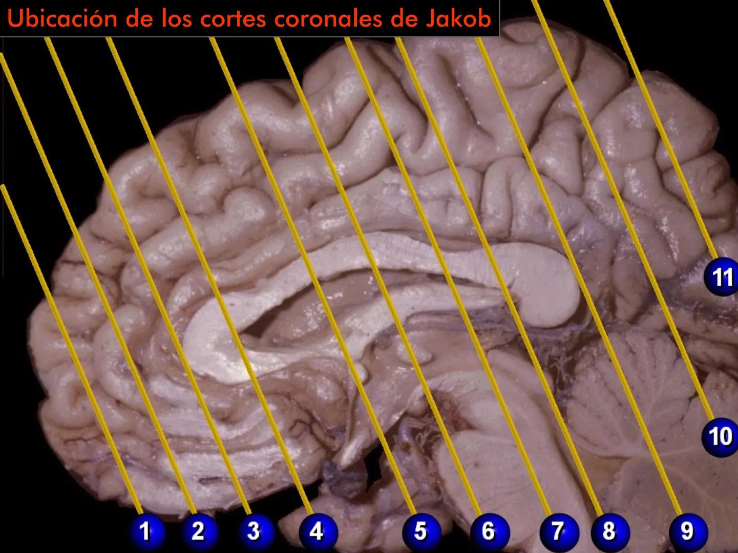 Cortes
de Cerebro
Autores:
Valeria A Forlizzi
Eduardo A Pró
Diseño:
Fernando M Forlizzi
ν.2005.α # Corte sagital medio de encéfalo # Partes