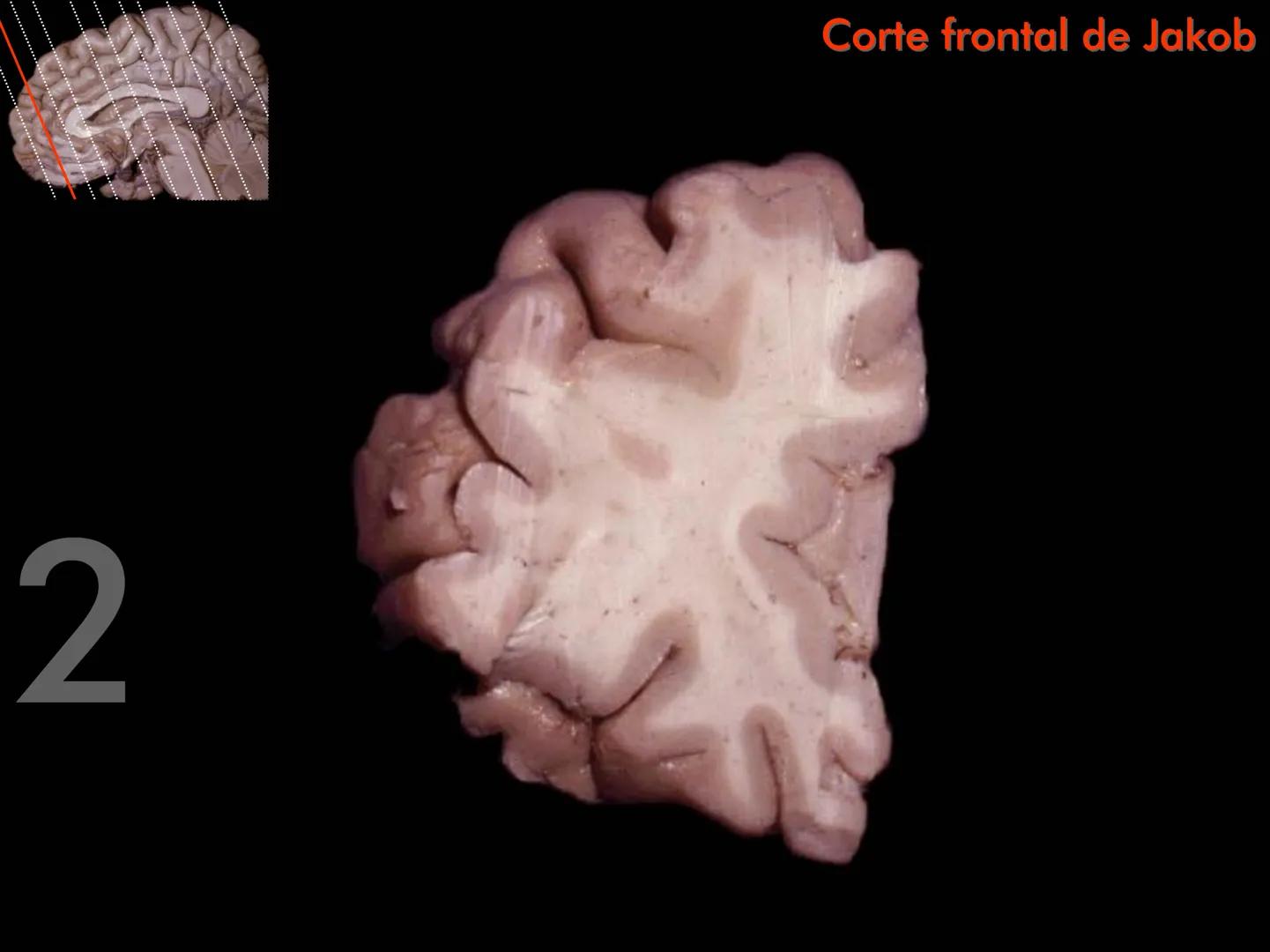 Cortes
de Cerebro
Autores:
Valeria A Forlizzi
Eduardo A Pró
Diseño:
Fernando M Forlizzi
ν.2005.α # Corte sagital medio de encéfalo # Partes