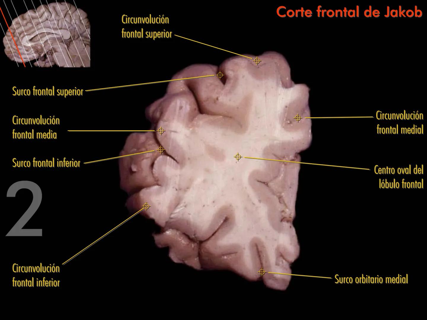 Cortes
de Cerebro
Autores:
Valeria A Forlizzi
Eduardo A Pró
Diseño:
Fernando M Forlizzi
ν.2005.α # Corte sagital medio de encéfalo # Partes