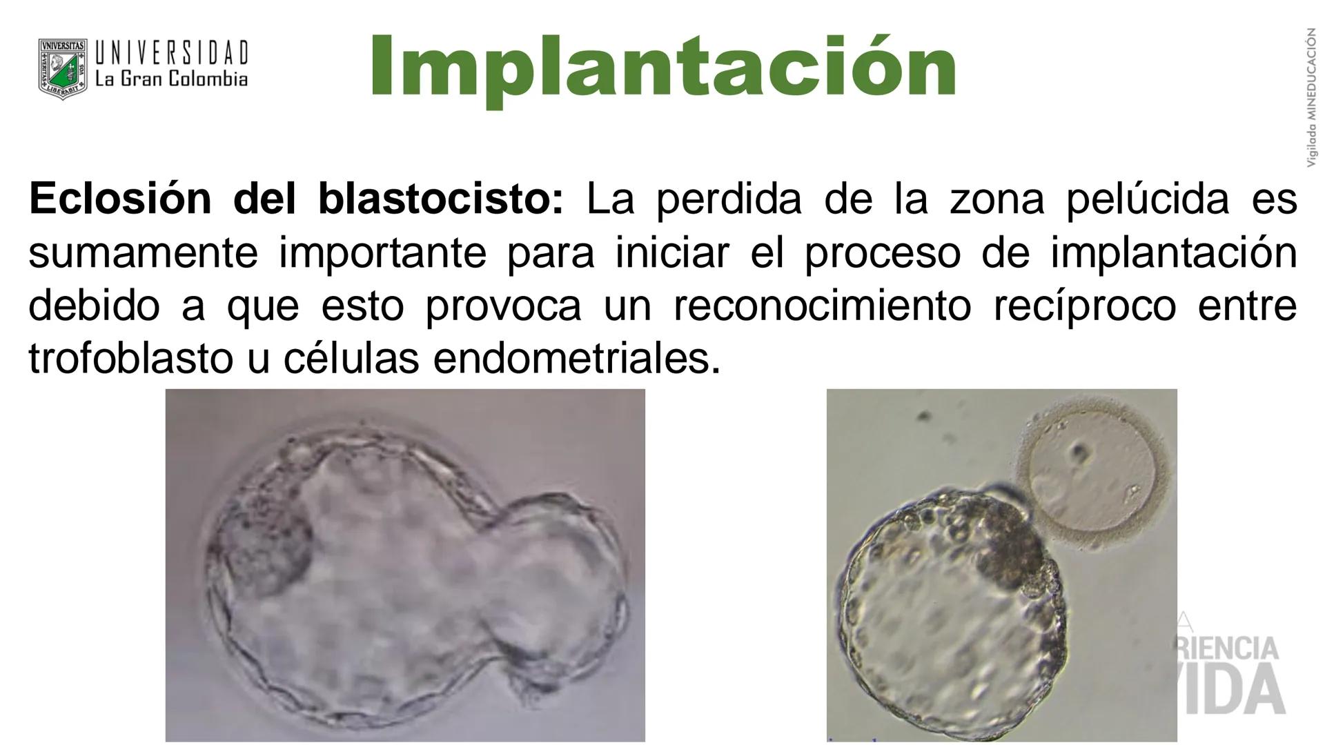--- OCR Start ---
Aspiró el aire cálido, se detuvo en mitad de la aspiración,
se estiró y murió.
Leon Tolstói. La muerte de Iván Ilich. 1886