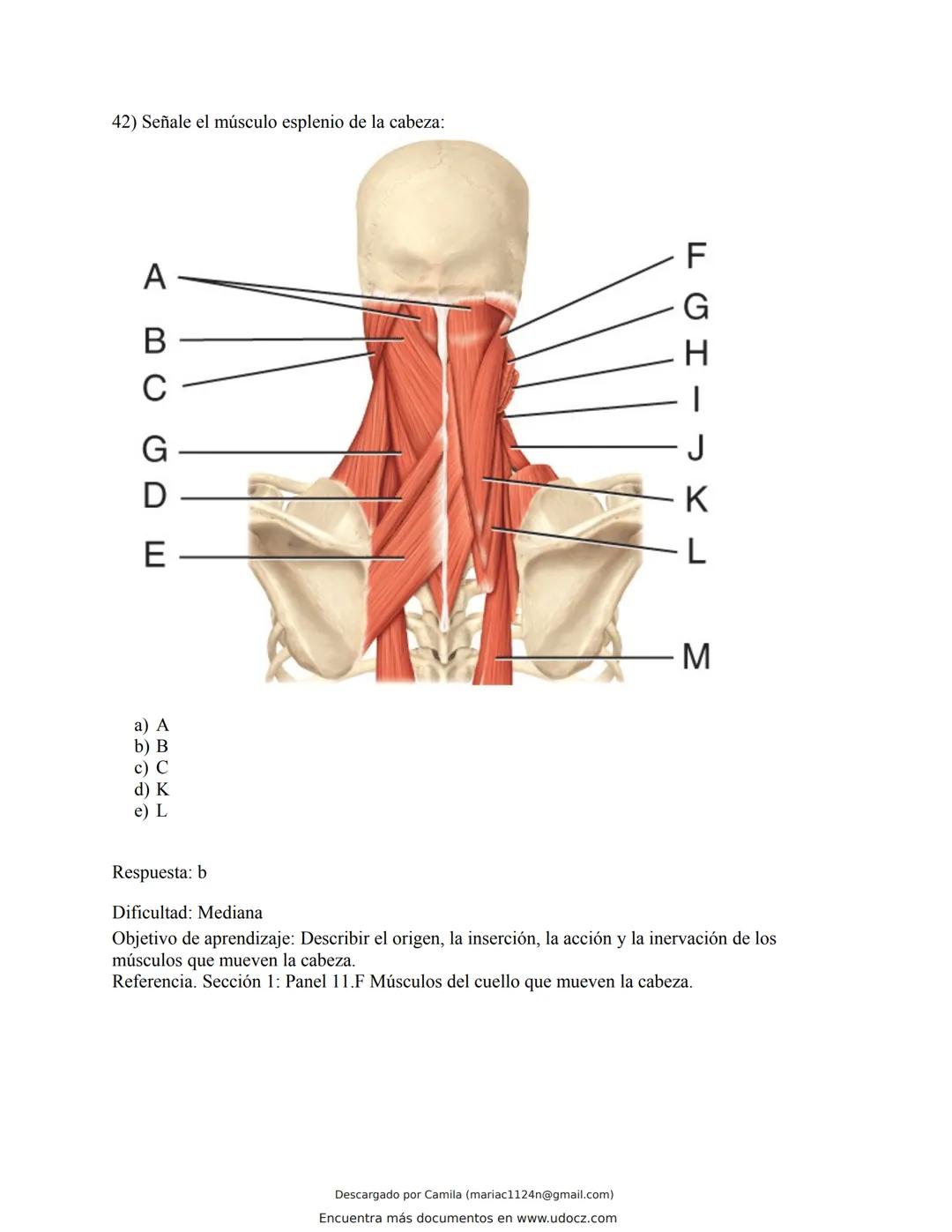 # Docz
Accede a apuntes, guías, libros y más de tu carrera
Banco Preguntas Cap11 Tortora
103 pag.
Descargado por Camila (mariac1124n@gmail
