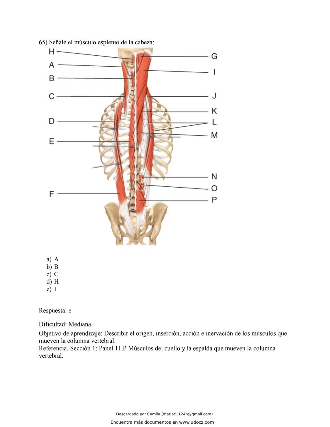 # Docz
Accede a apuntes, guías, libros y más de tu carrera
Banco Preguntas Cap11 Tortora
103 pag.
Descargado por Camila (mariac1124n@gmail