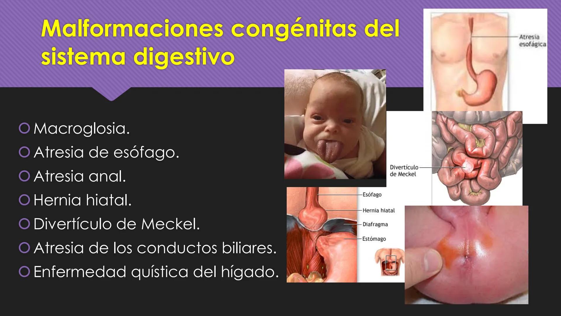 # Periodo Embrionario
Embriología
Dra. Helida Avendaño Maz
UNICOC DEFINICIÓN
O Se extiende desde la cuarta semana hasta la
octava semana de