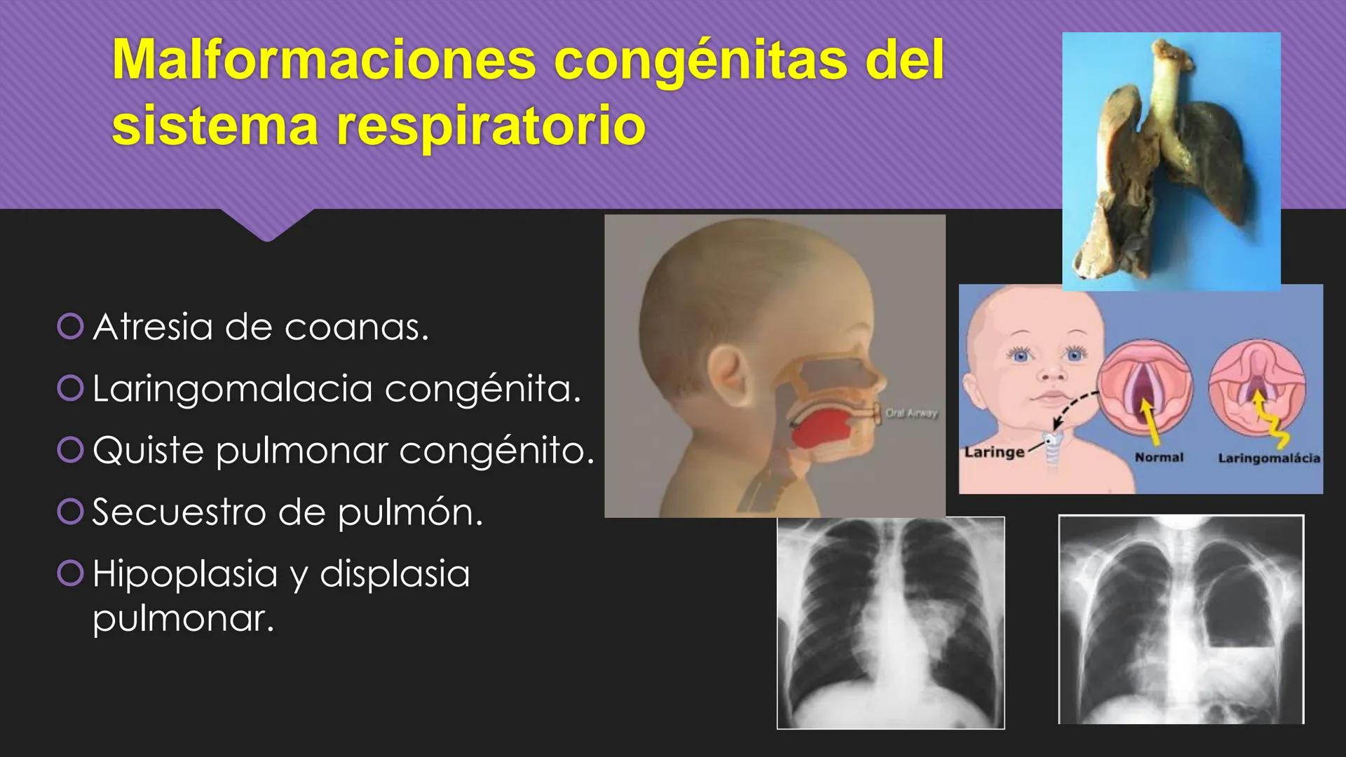 # Periodo Embrionario
Embriología
Dra. Helida Avendaño Maz
UNICOC DEFINICIÓN
O Se extiende desde la cuarta semana hasta la
octava semana de