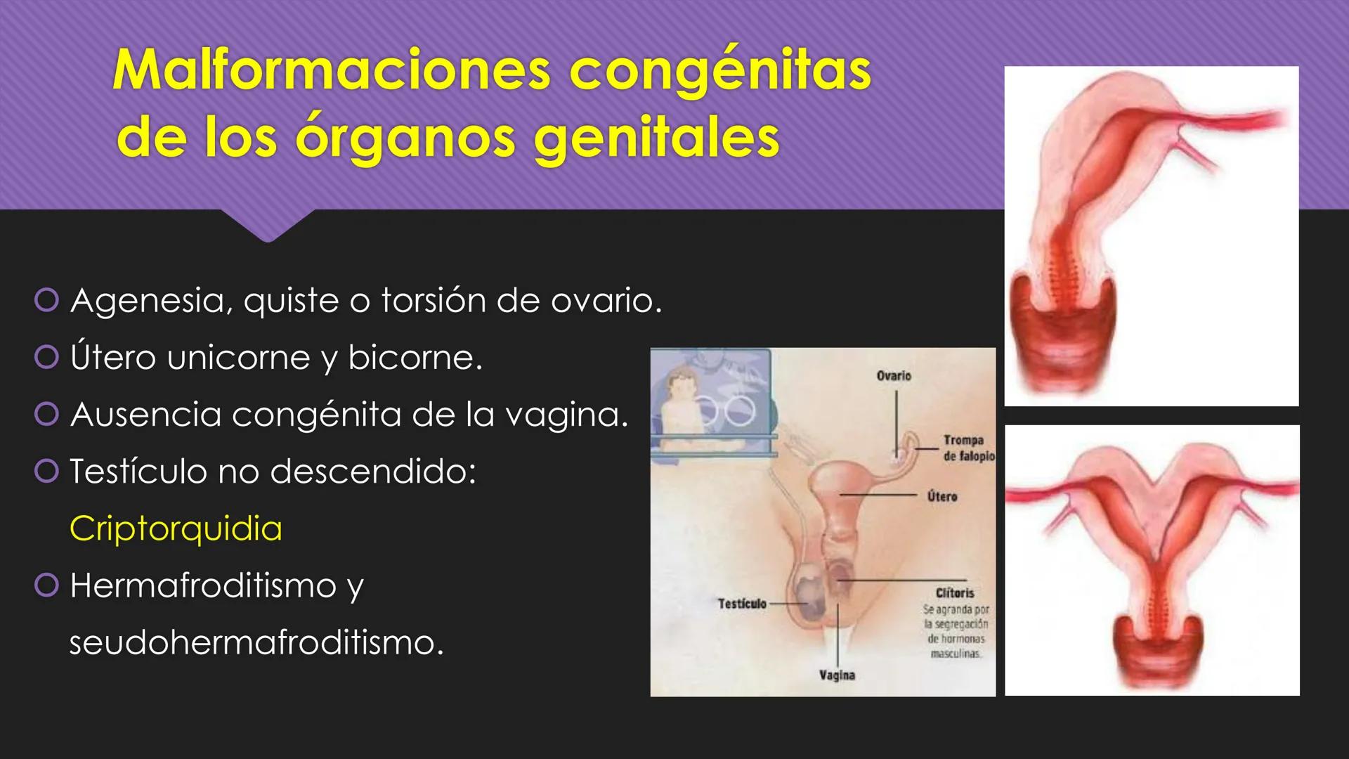 # Periodo Embrionario
Embriología
Dra. Helida Avendaño Maz
UNICOC DEFINICIÓN
O Se extiende desde la cuarta semana hasta la
octava semana de