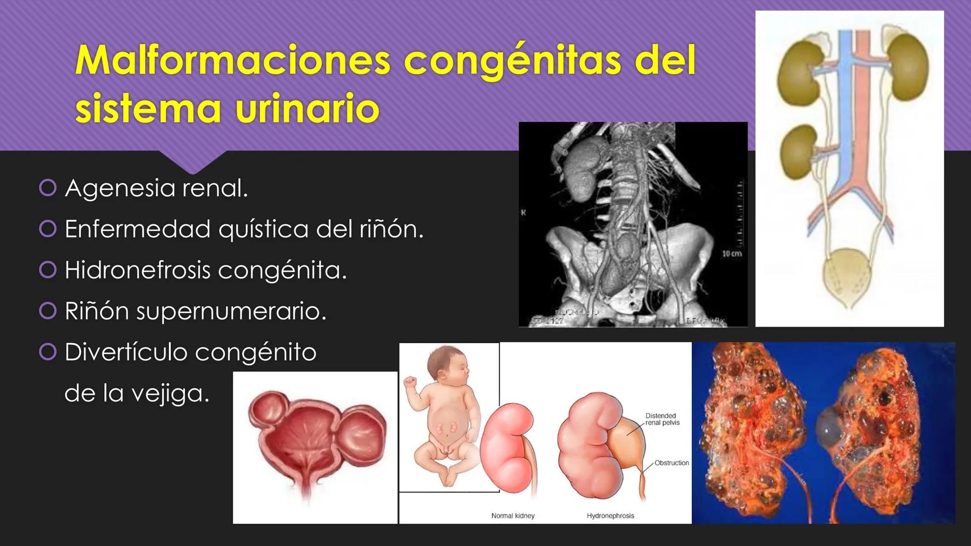 # Periodo Embrionario
Embriología
Dra. Helida Avendaño Maz
UNICOC DEFINICIÓN
O Se extiende desde la cuarta semana hasta la
octava semana de