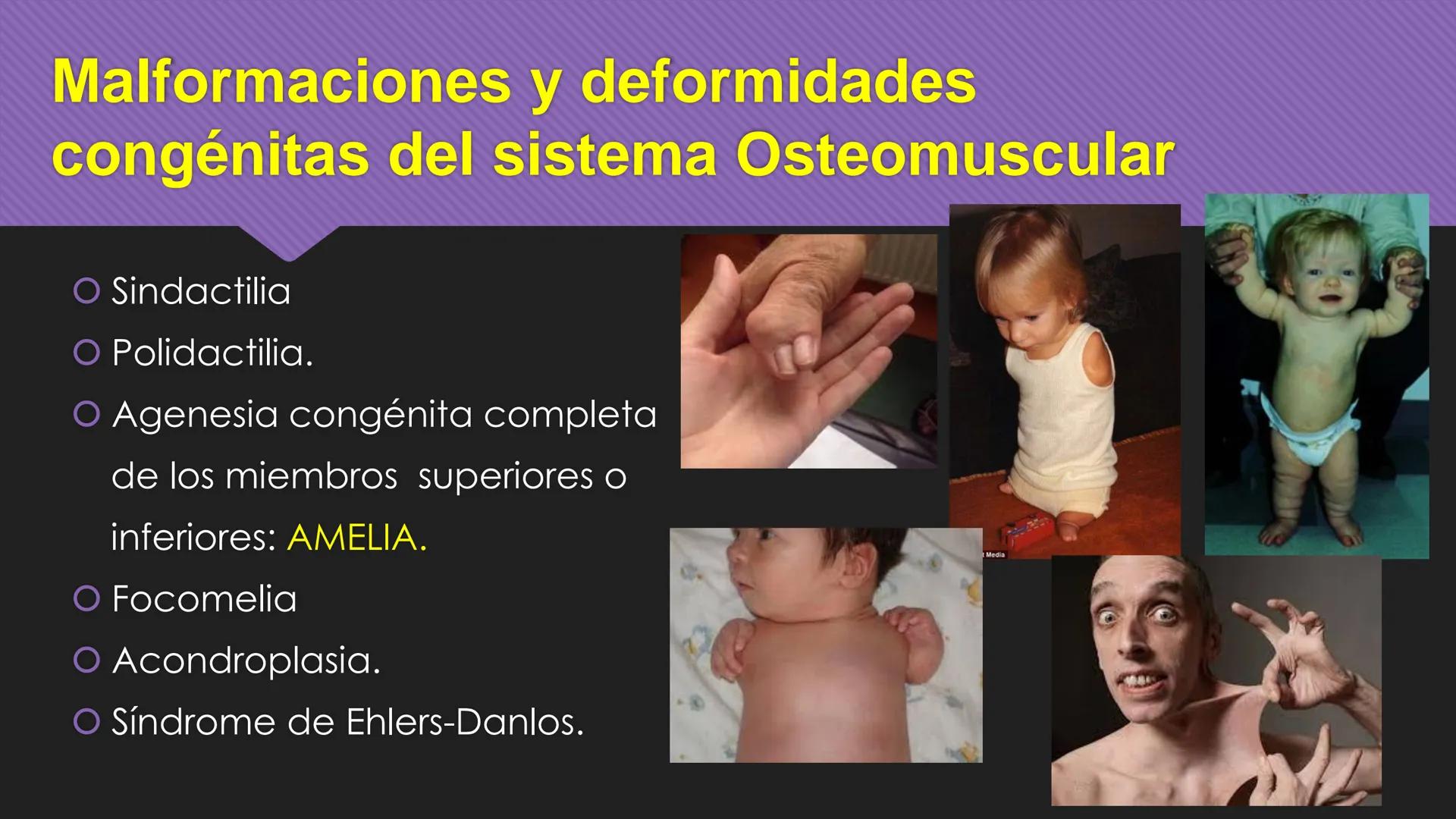 # Periodo Embrionario
Embriología
Dra. Helida Avendaño Maz
UNICOC DEFINICIÓN
O Se extiende desde la cuarta semana hasta la
octava semana de