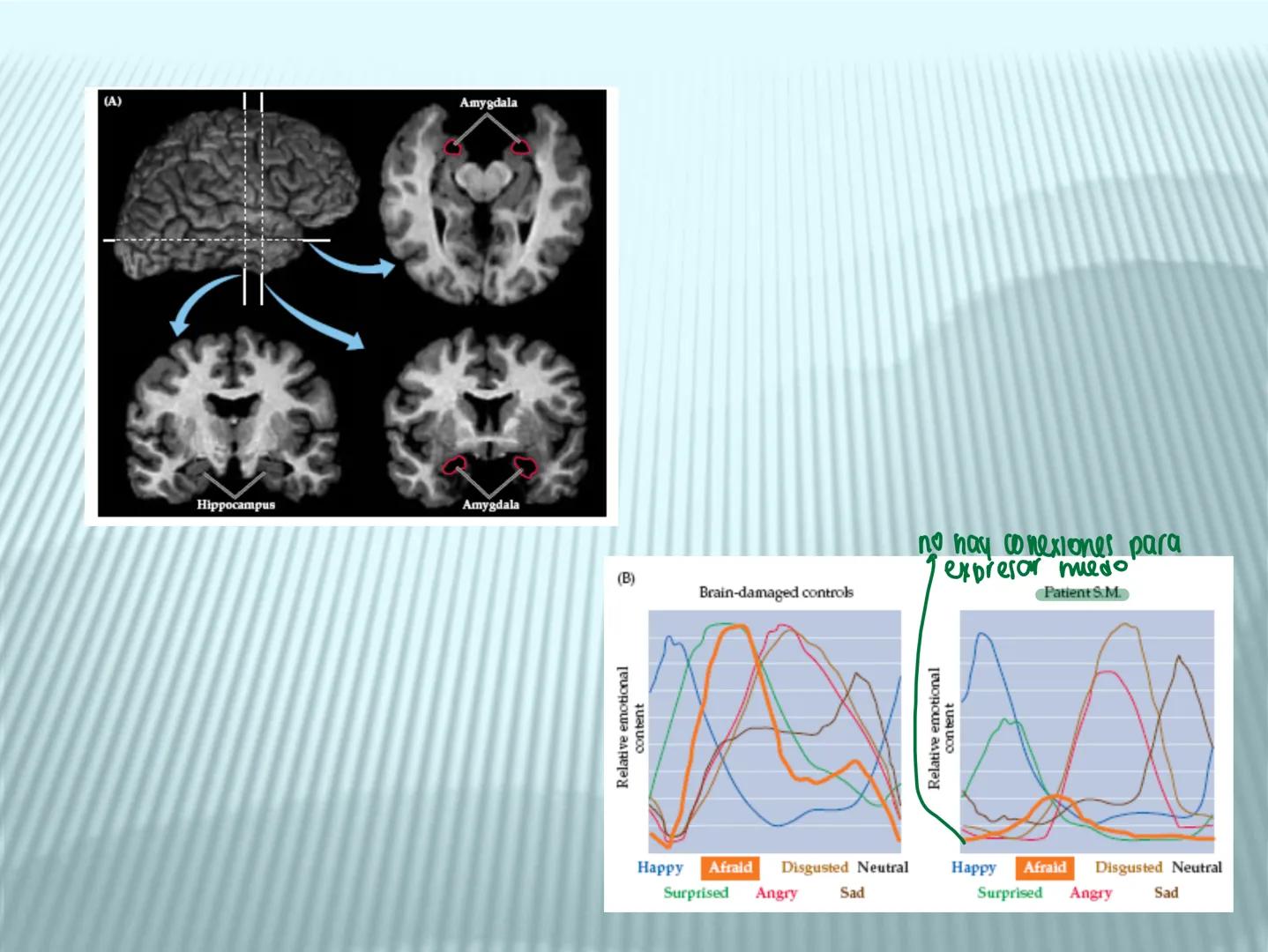 # cerebro
# corazon
# FIGHT!
# NEUROPSICOLOGIA DE LA EMOCION
Adriana M. Martínez M.
25-11-04 GENERALIDADES
? Tiemblo porque tengo miedo