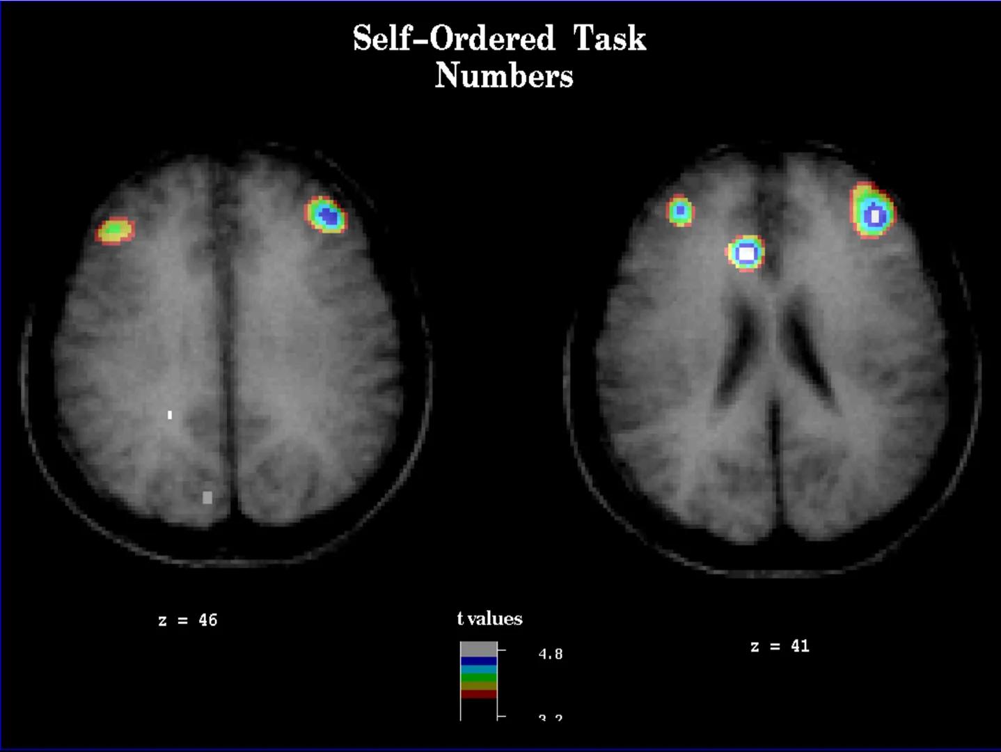 Neuropsicología de las
Funciones ejecutivas
Adriana M. Martínez M.
Ms. RHN y EC-UAB ejecutar
Para vivir las personas deben actuar; para
actu