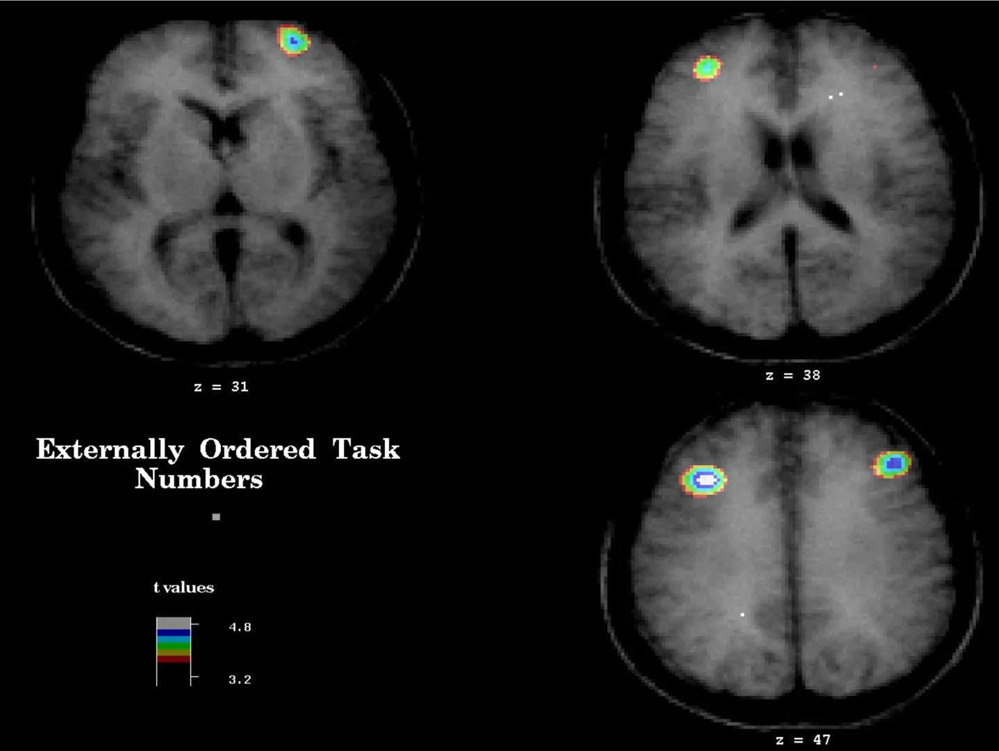 Neuropsicología de las
Funciones ejecutivas
Adriana M. Martínez M.
Ms. RHN y EC-UAB ejecutar
Para vivir las personas deben actuar; para
actu