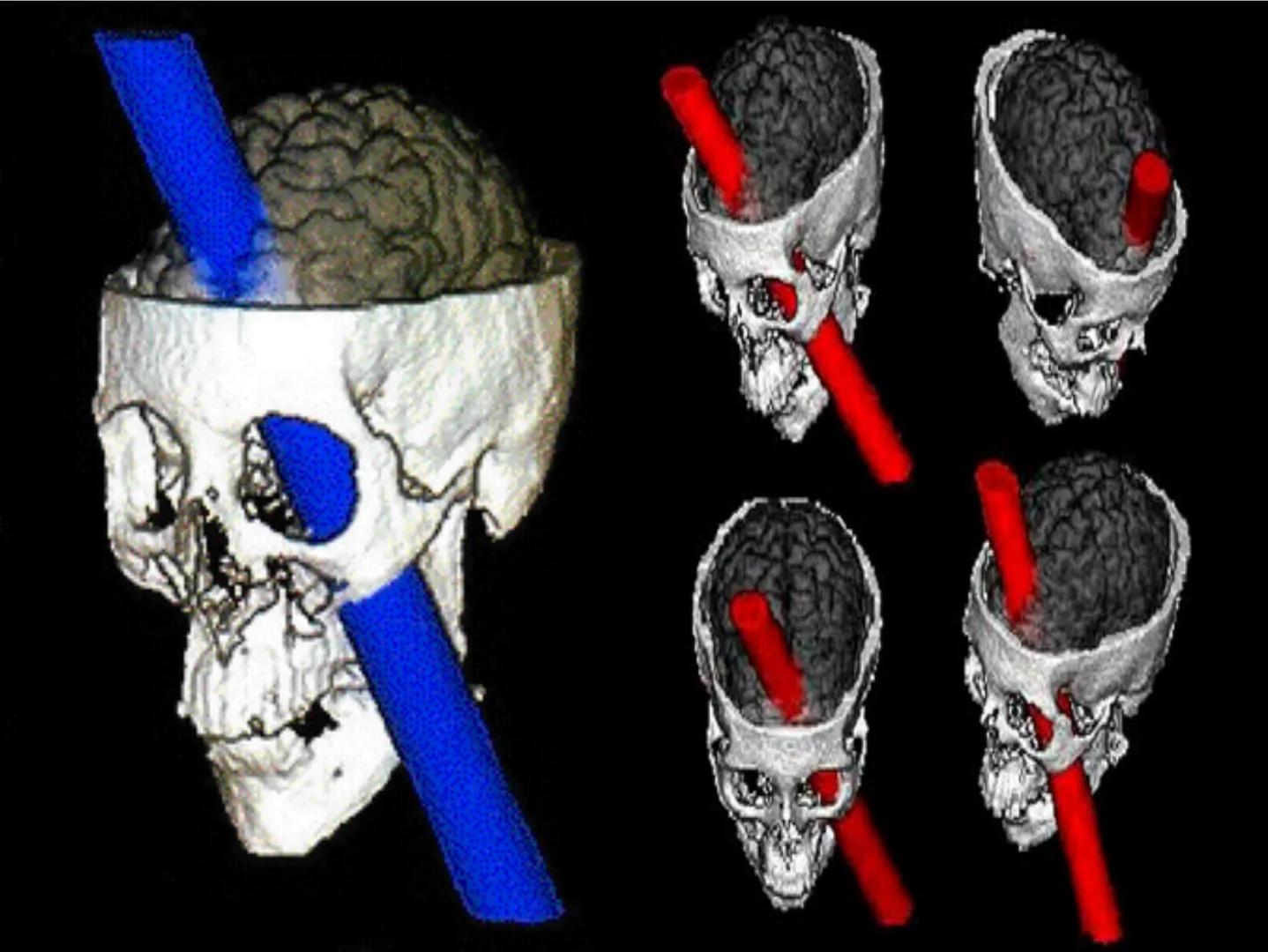 Neuropsicología de las
Funciones ejecutivas
Adriana M. Martínez M.
Ms. RHN y EC-UAB ejecutar
Para vivir las personas deben actuar; para
actu