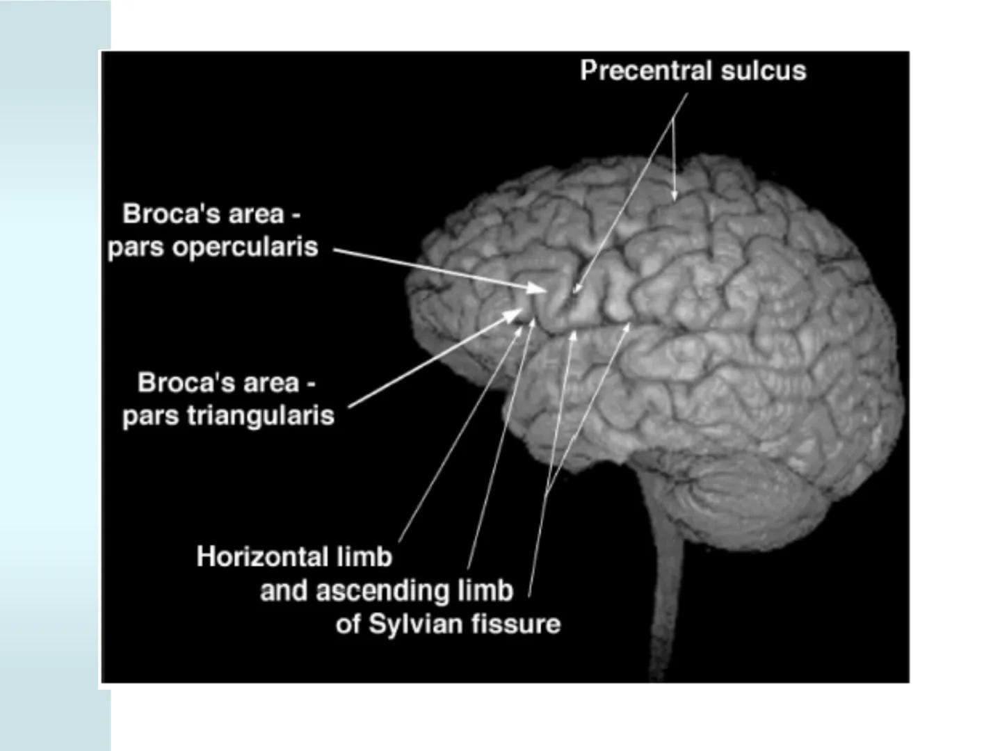# NEUROPSICOLOGIA DEL
LENGUAJE
ADRIANA M. MARTINEZ
Máster en Rehabilitación Neuropsicológica y
Estimulación Cognitiva- UAB Definición
? -