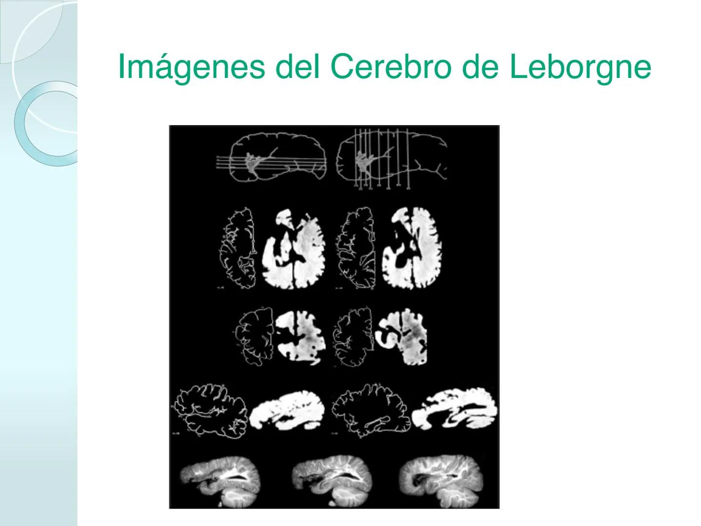 # NEUROPSICOLOGIA DEL
LENGUAJE
ADRIANA M. MARTINEZ
Máster en Rehabilitación Neuropsicológica y
Estimulación Cognitiva- UAB Definición
? -