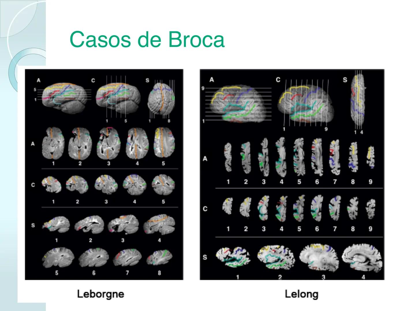 # NEUROPSICOLOGIA DEL
LENGUAJE
ADRIANA M. MARTINEZ
Máster en Rehabilitación Neuropsicológica y
Estimulación Cognitiva- UAB Definición
? -