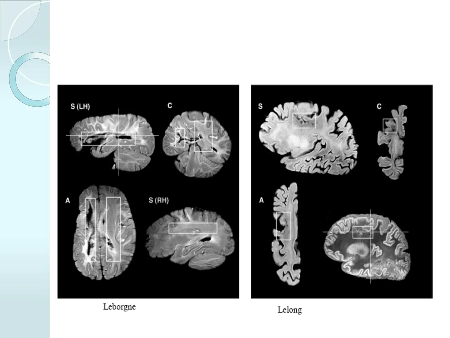 # NEUROPSICOLOGIA DEL
LENGUAJE
ADRIANA M. MARTINEZ
Máster en Rehabilitación Neuropsicológica y
Estimulación Cognitiva- UAB Definición
? -