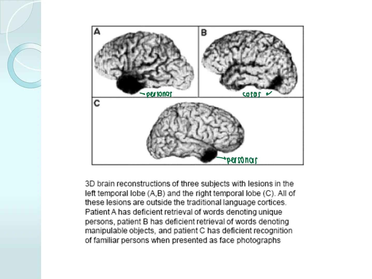 # NEUROPSICOLOGIA DEL
LENGUAJE
ADRIANA M. MARTINEZ
Máster en Rehabilitación Neuropsicológica y
Estimulación Cognitiva- UAB Definición
? -