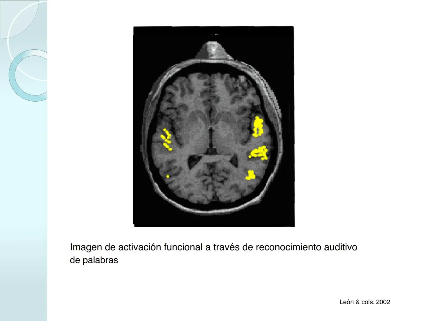 # NEUROPSICOLOGIA DEL
LENGUAJE
ADRIANA M. MARTINEZ
Máster en Rehabilitación Neuropsicológica y
Estimulación Cognitiva- UAB Definición
? -