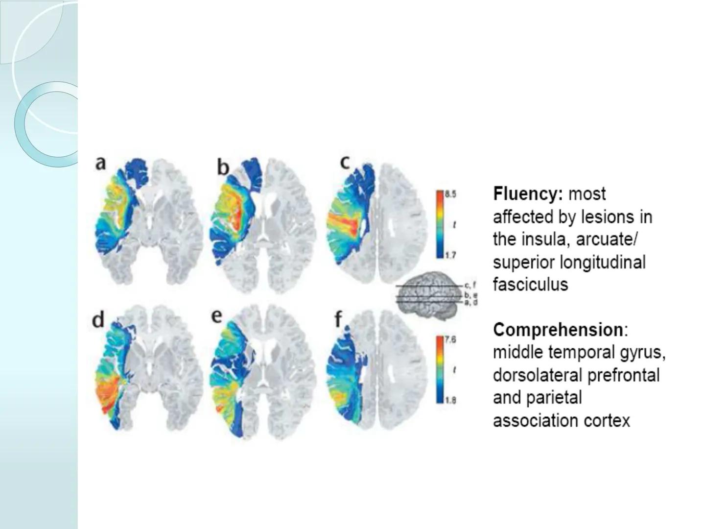 # NEUROPSICOLOGIA DEL
LENGUAJE
ADRIANA M. MARTINEZ
Máster en Rehabilitación Neuropsicológica y
Estimulación Cognitiva- UAB Definición
? -