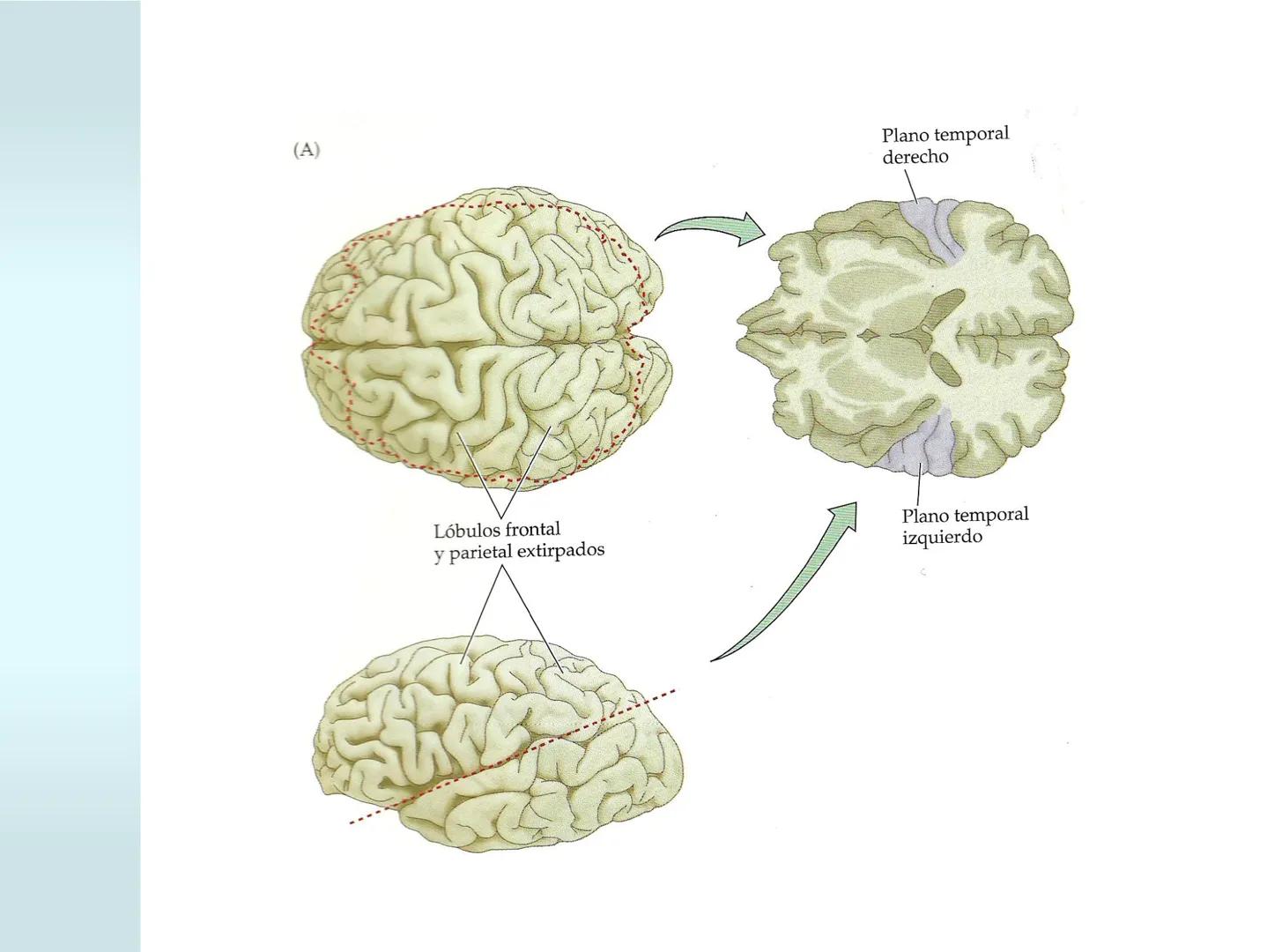 # NEUROPSICOLOGIA DEL
LENGUAJE
ADRIANA M. MARTINEZ
Máster en Rehabilitación Neuropsicológica y
Estimulación Cognitiva- UAB Definición
? -