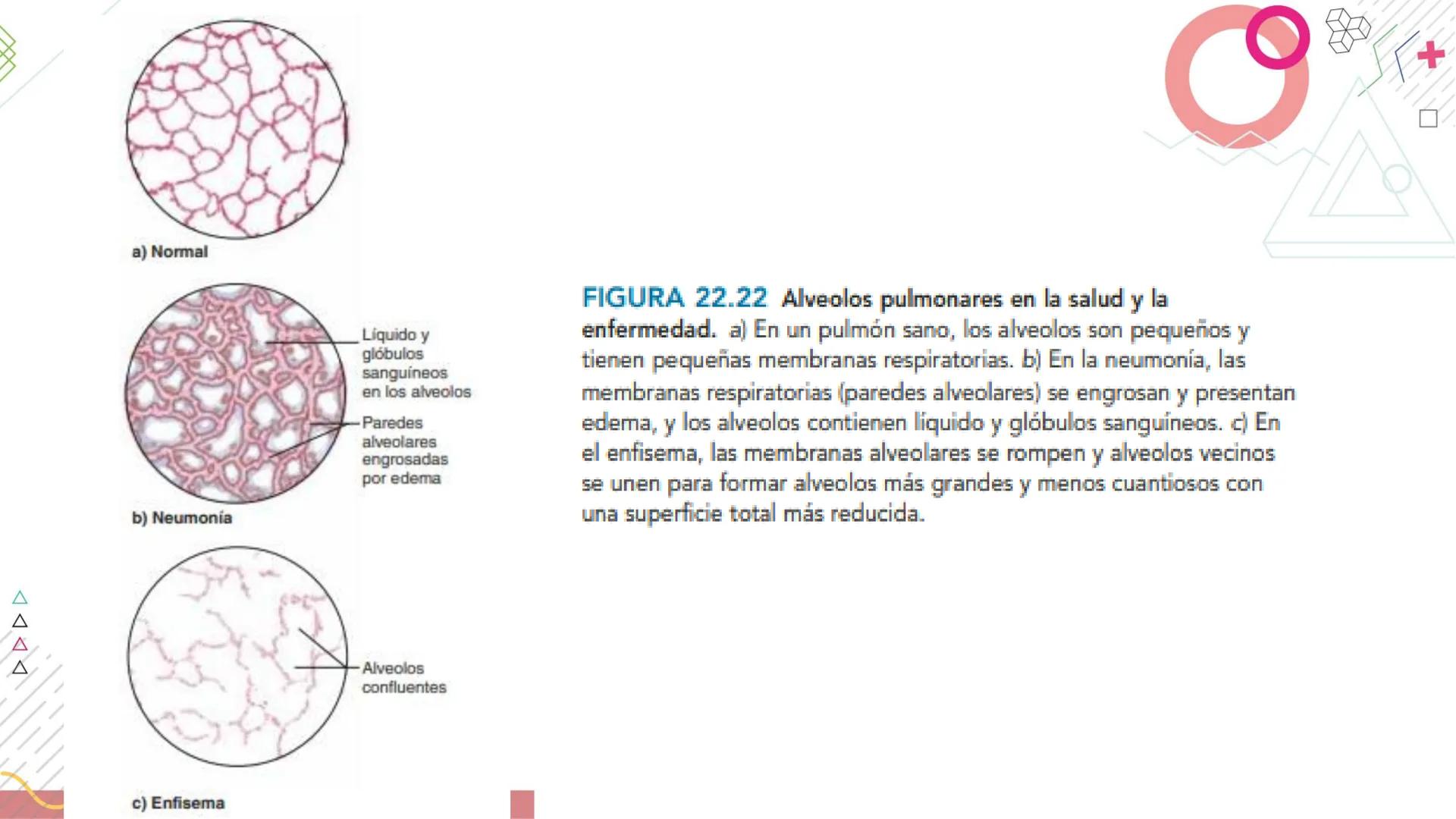# SISTEMA
RESPIRATORIO
Docente: Jacqueline Betancur Bustamante
FUMC
María Cano
Fundación Universitaria
Vigilada MinEducación
Acredi
tac