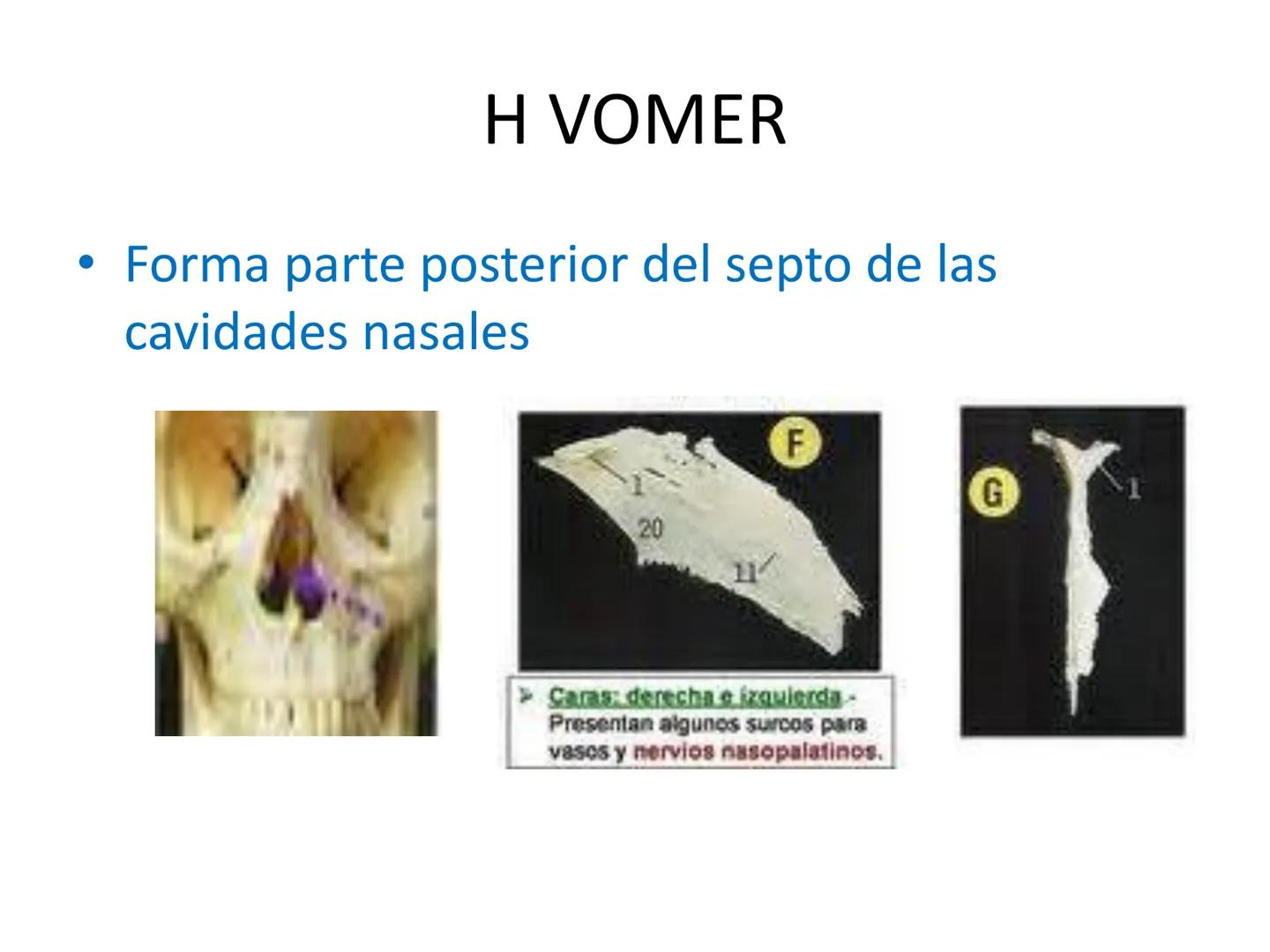 # HUESOS DE LA CABEZA Y
DEL CRANEO
please chek to en
Docente:
Msc. Gerly David Escalante Contrera FUNCION
• Proteger al encéfalo y sus an