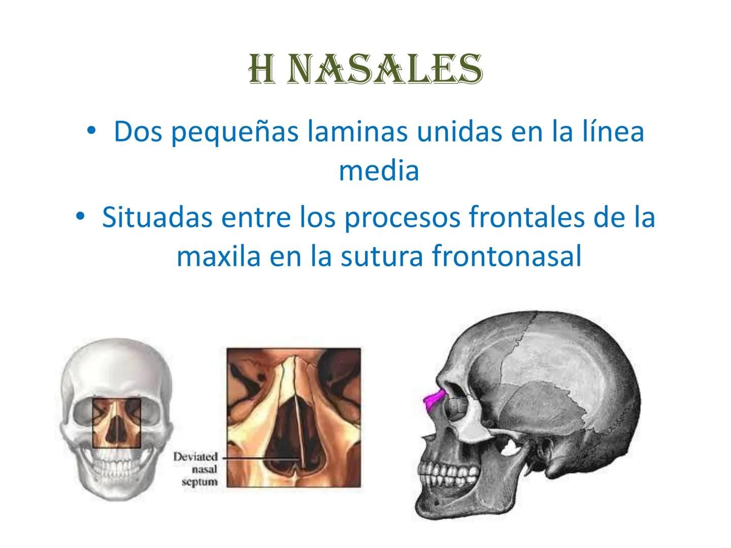 # HUESOS DE LA CABEZA Y
DEL CRANEO
please chek to en
Docente:
Msc. Gerly David Escalante Contrera FUNCION
• Proteger al encéfalo y sus an