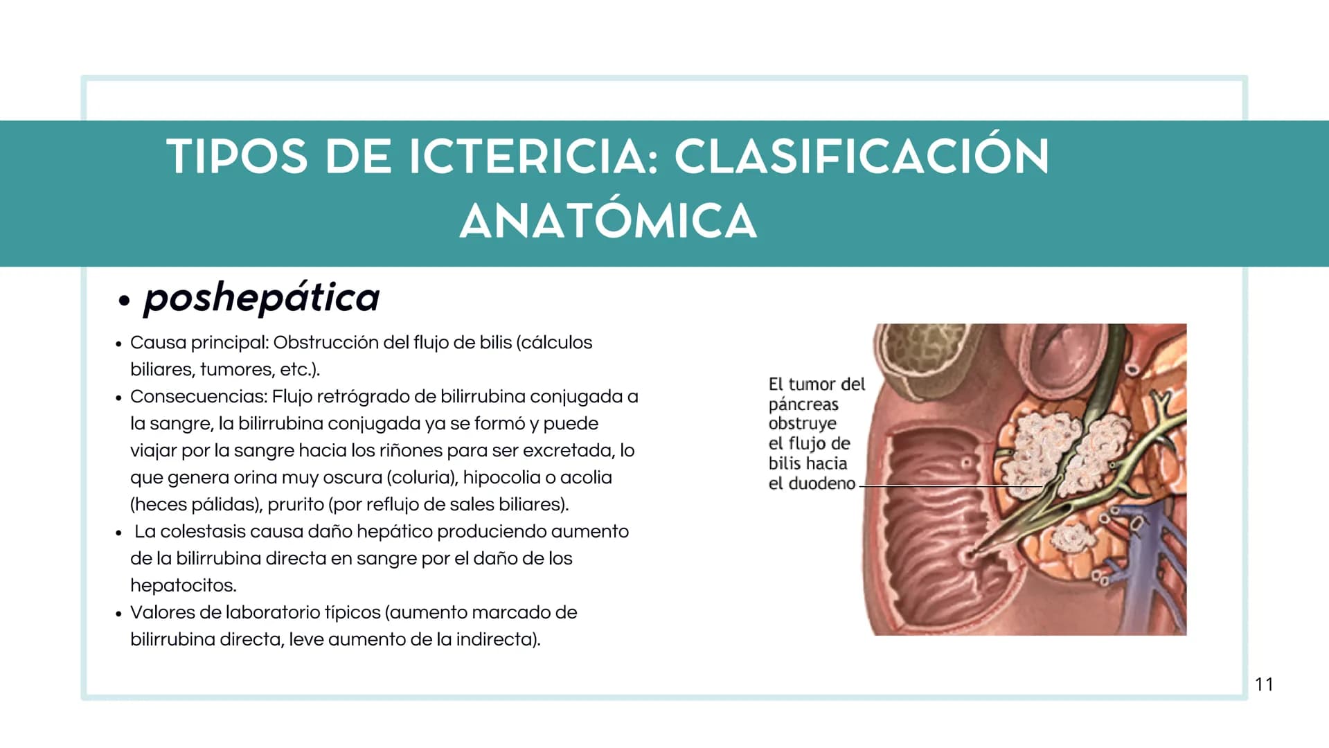 # FORMACIÓN DE LA BILIS
* Colesterol
* Electrolitos y
agua
* Sales Biliares
* Bilirrubina
* Fosfolipidos
Canal biliar
Arteri