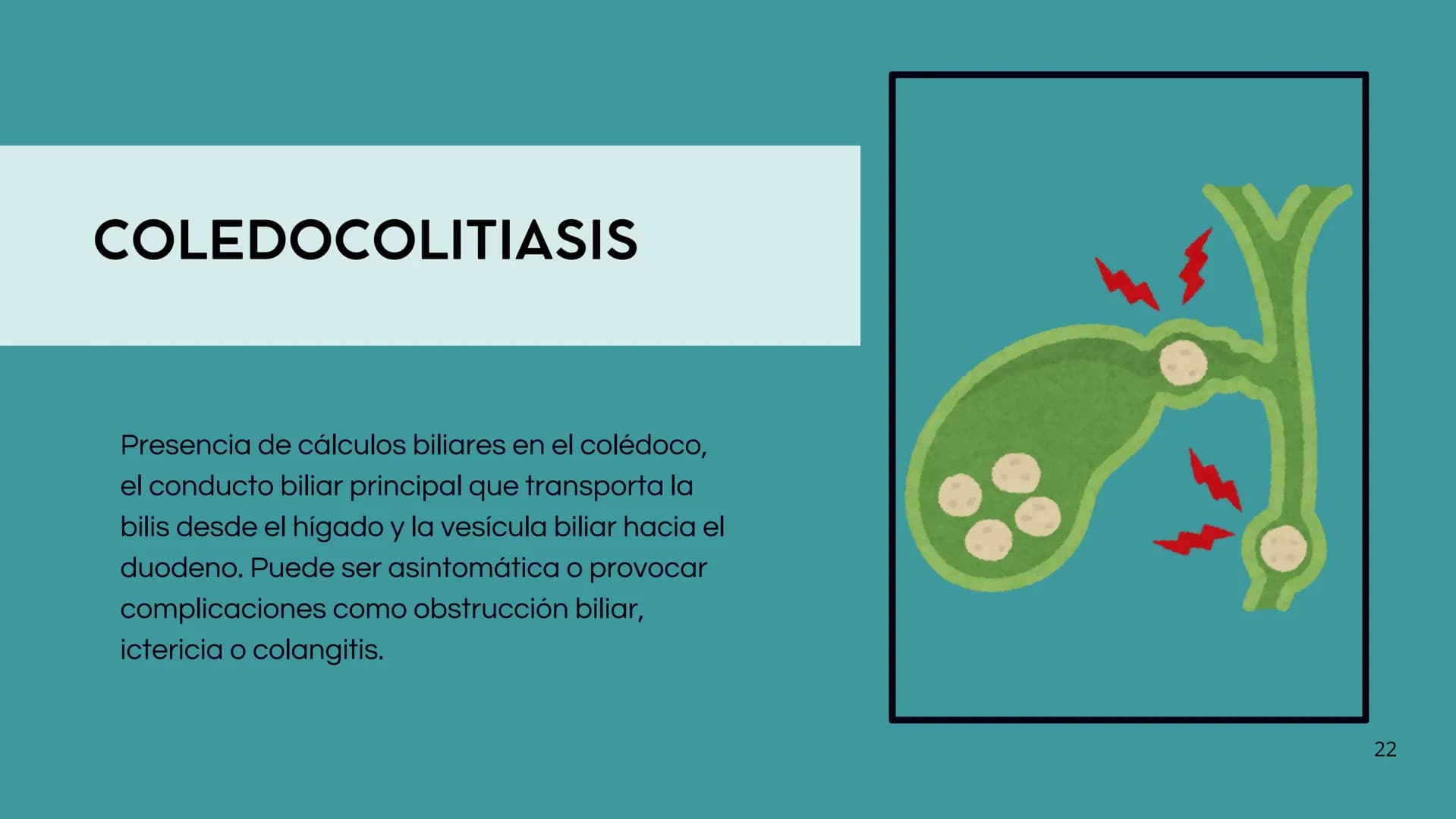 # FORMACIÓN DE LA BILIS
* Colesterol
* Electrolitos y
agua
* Sales Biliares
* Bilirrubina
* Fosfolipidos
Canal biliar
Arteri