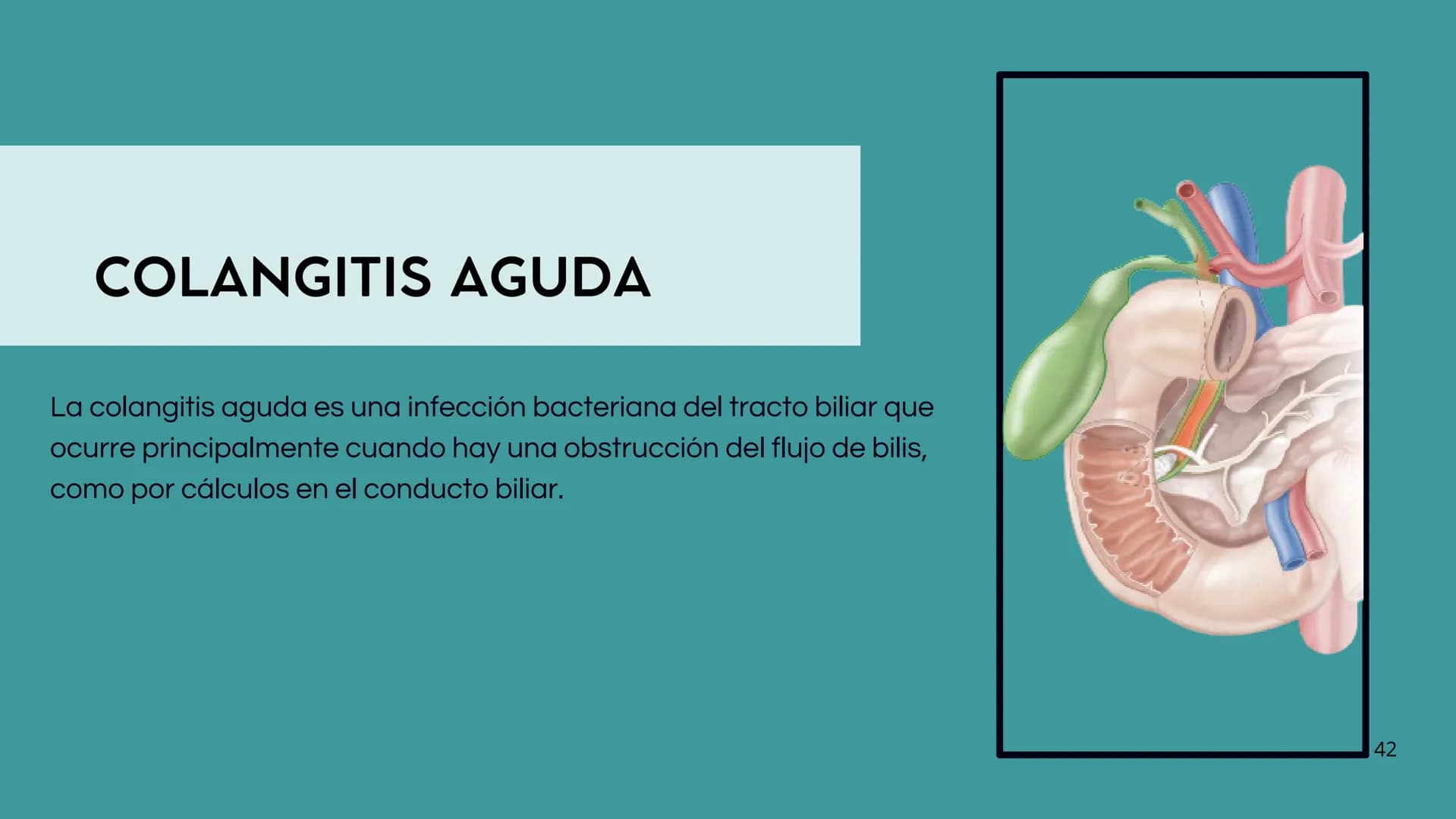 # FORMACIÓN DE LA BILIS
* Colesterol
* Electrolitos y
agua
* Sales Biliares
* Bilirrubina
* Fosfolipidos
Canal biliar
Arteri