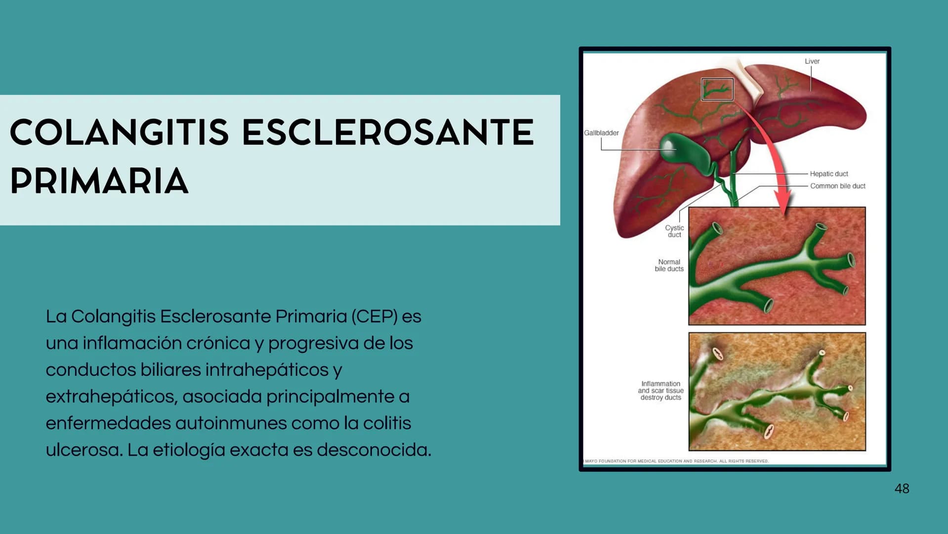 # FORMACIÓN DE LA BILIS
* Colesterol
* Electrolitos y
agua
* Sales Biliares
* Bilirrubina
* Fosfolipidos
Canal biliar
Arteri
