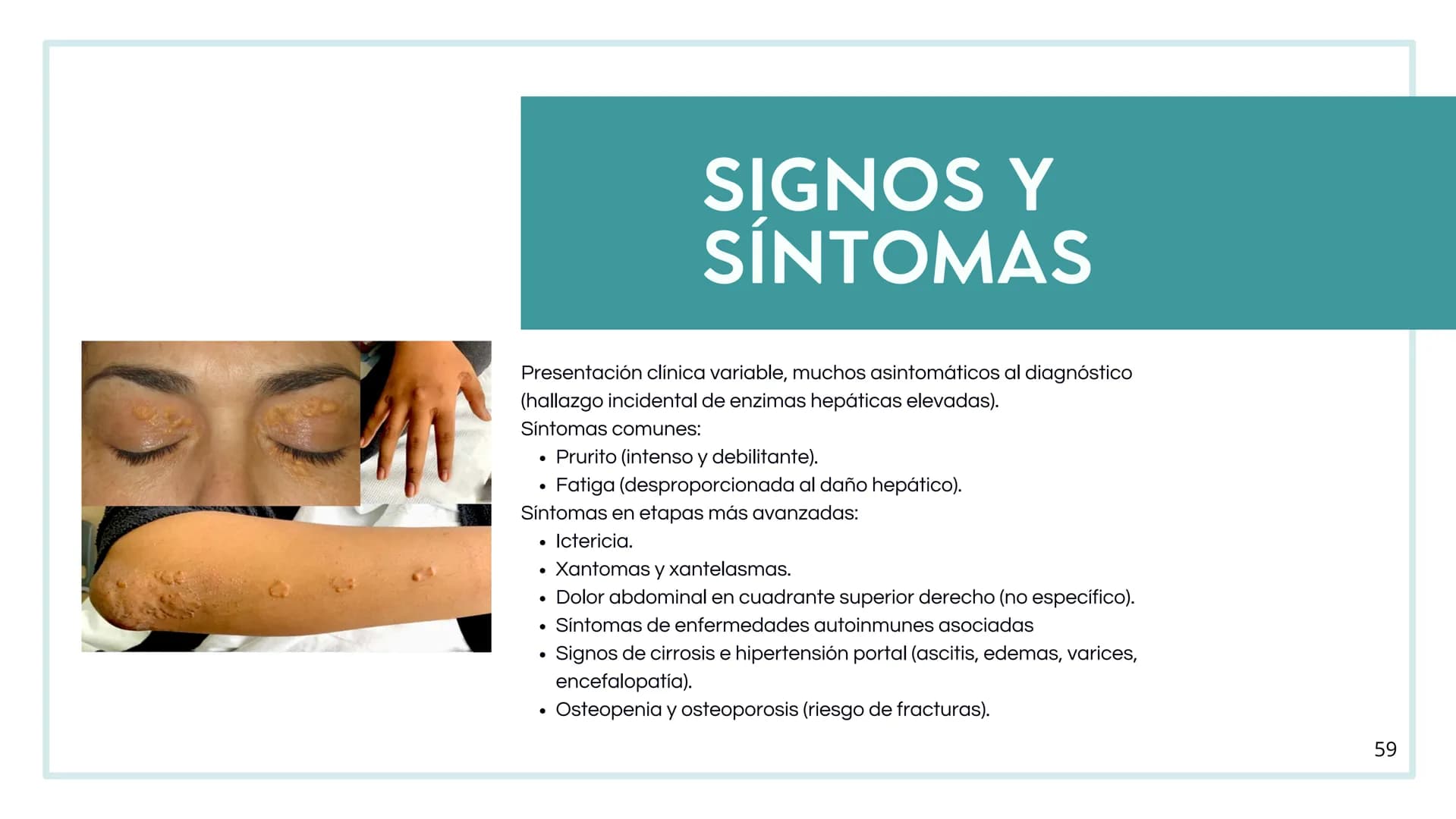 # FORMACIÓN DE LA BILIS
* Colesterol
* Electrolitos y
agua
* Sales Biliares
* Bilirrubina
* Fosfolipidos
Canal biliar
Arteri