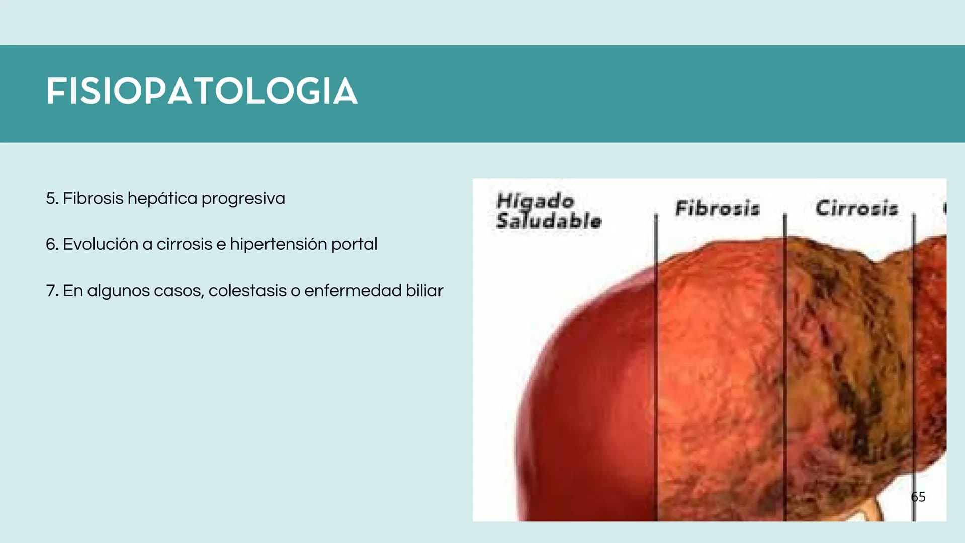 # FORMACIÓN DE LA BILIS
* Colesterol
* Electrolitos y
agua
* Sales Biliares
* Bilirrubina
* Fosfolipidos
Canal biliar
Arteri
