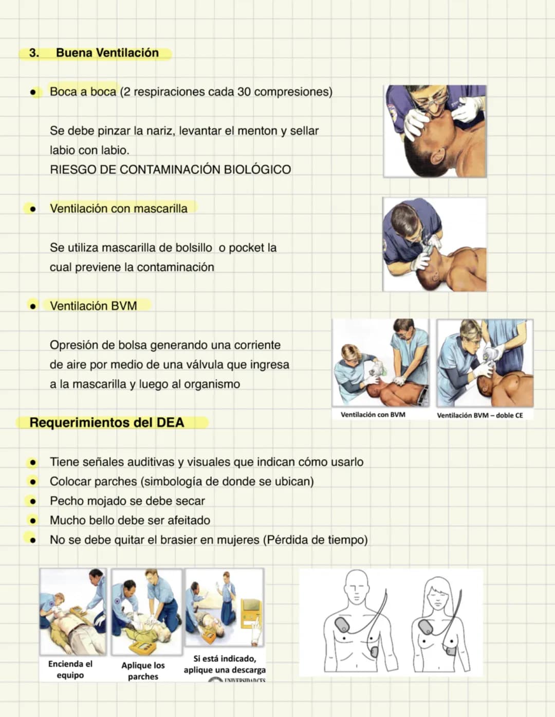# Atención Inicial al Paciente
Reanimación cerebro cardiopulmonar en el paciente adulto y pediatrico
- Paro cardiaco: Interrupción súbita d