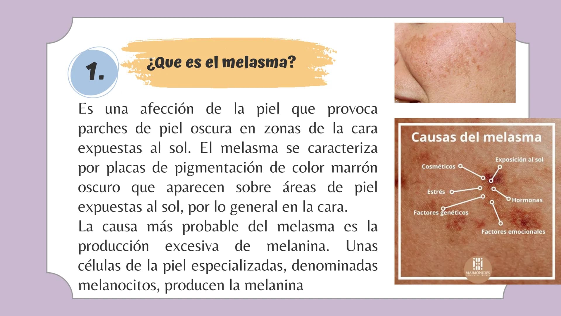 # Tabla de contenido
1. ¿Que es ?
4. ¿Como corregirlo?
2. Tipos de Melasma
5. ¿Se puede maquillar?
3. Productos para tratarlo 1.
## ¿Que es