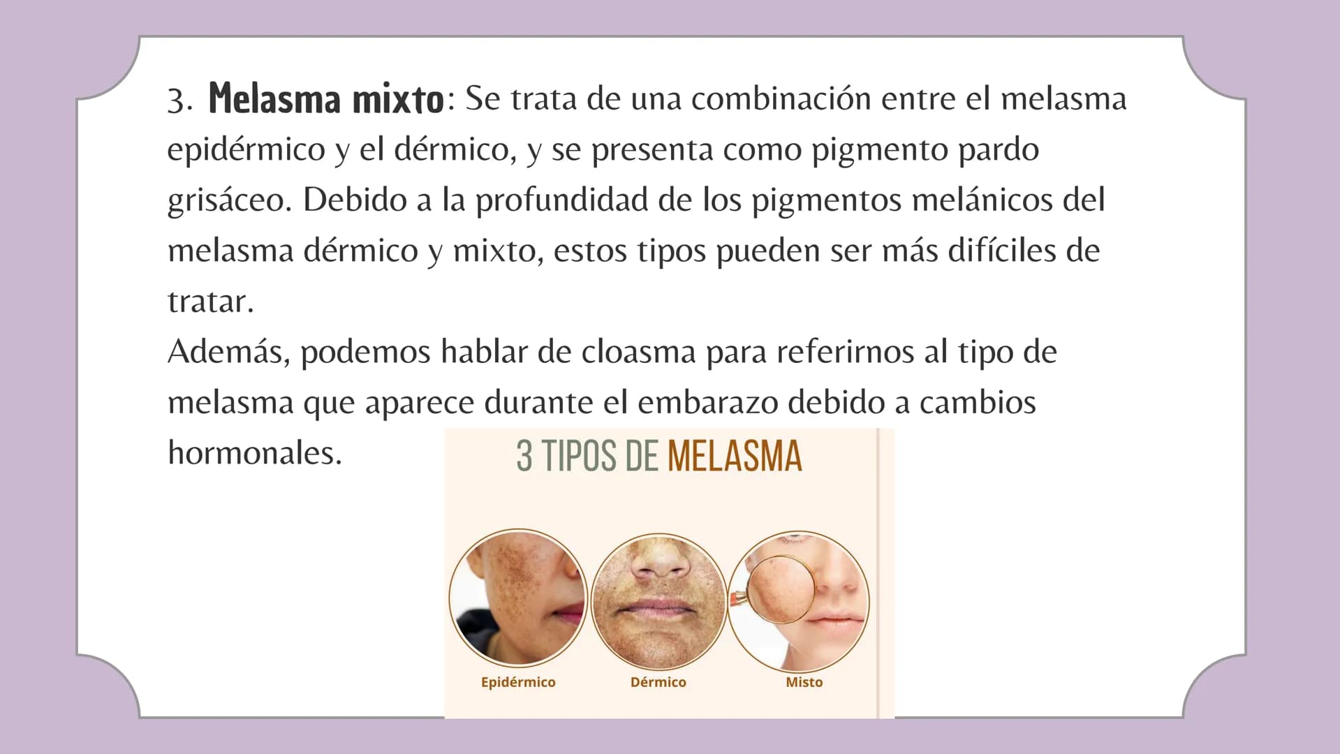 # Tabla de contenido
1. ¿Que es ?
4. ¿Como corregirlo?
2. Tipos de Melasma
5. ¿Se puede maquillar?
3. Productos para tratarlo 1.
## ¿Que es