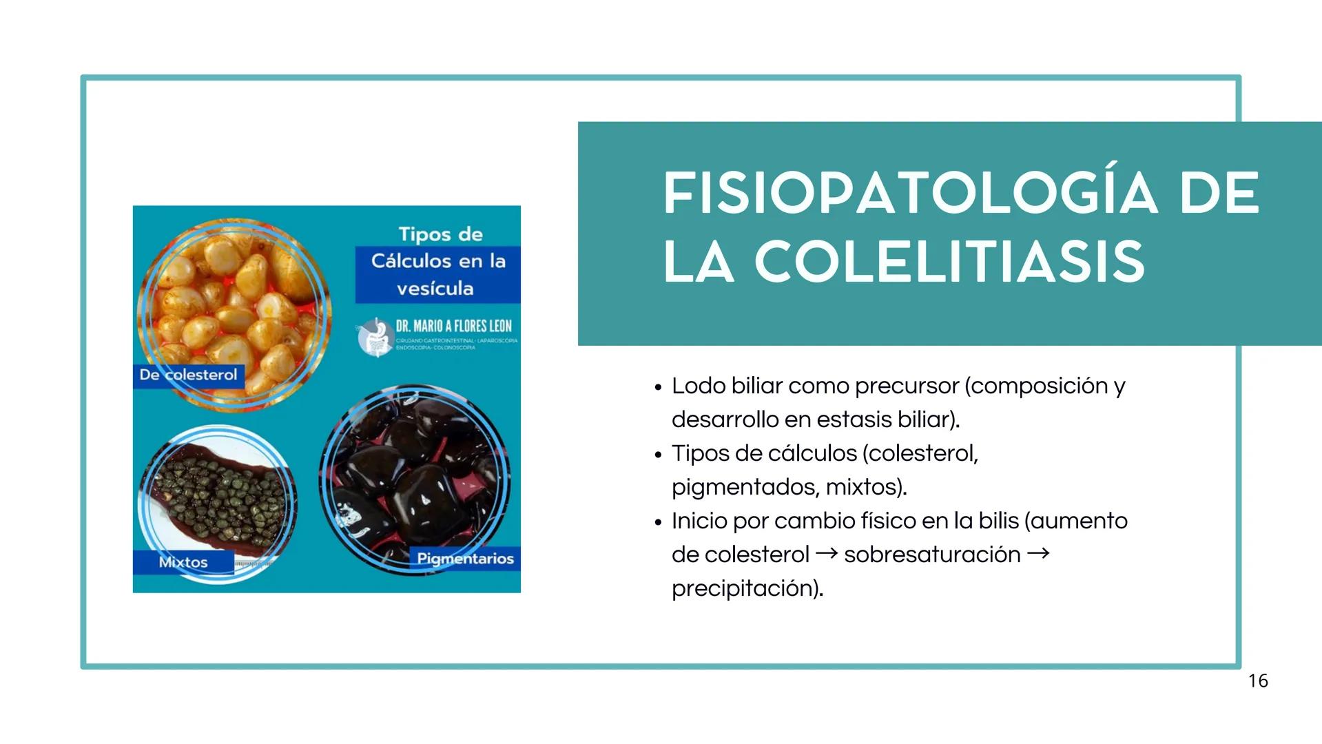 • Colesterol
• Electrolitos y
agua
• Sales Biliares
• Bilirrubina
• Fosfolipidos
FORMACIÓN DE LA
BILIS
Canal biliar
Arteria
Vena
Canaliculos
