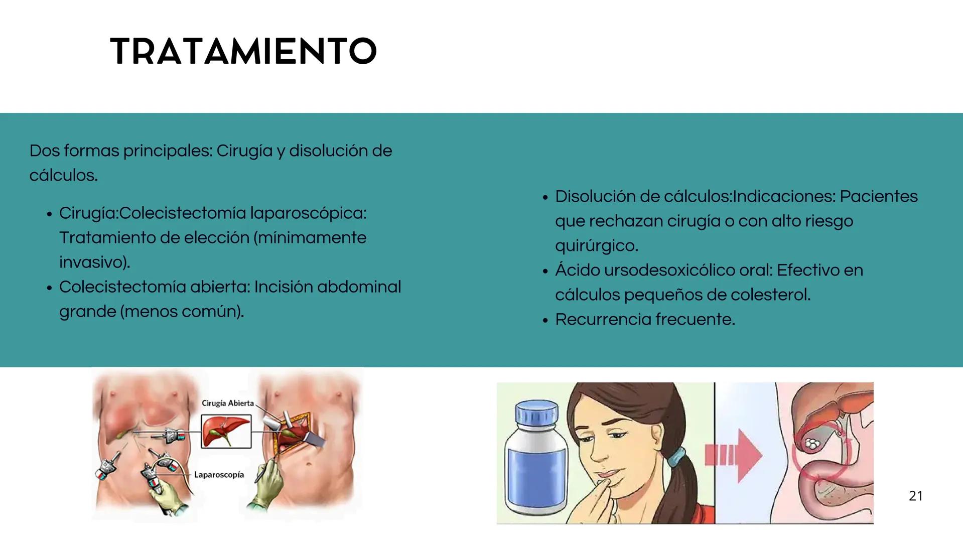 • Colesterol
• Electrolitos y
agua
• Sales Biliares
• Bilirrubina
• Fosfolipidos
FORMACIÓN DE LA
BILIS
Canal biliar
Arteria
Vena
Canaliculos